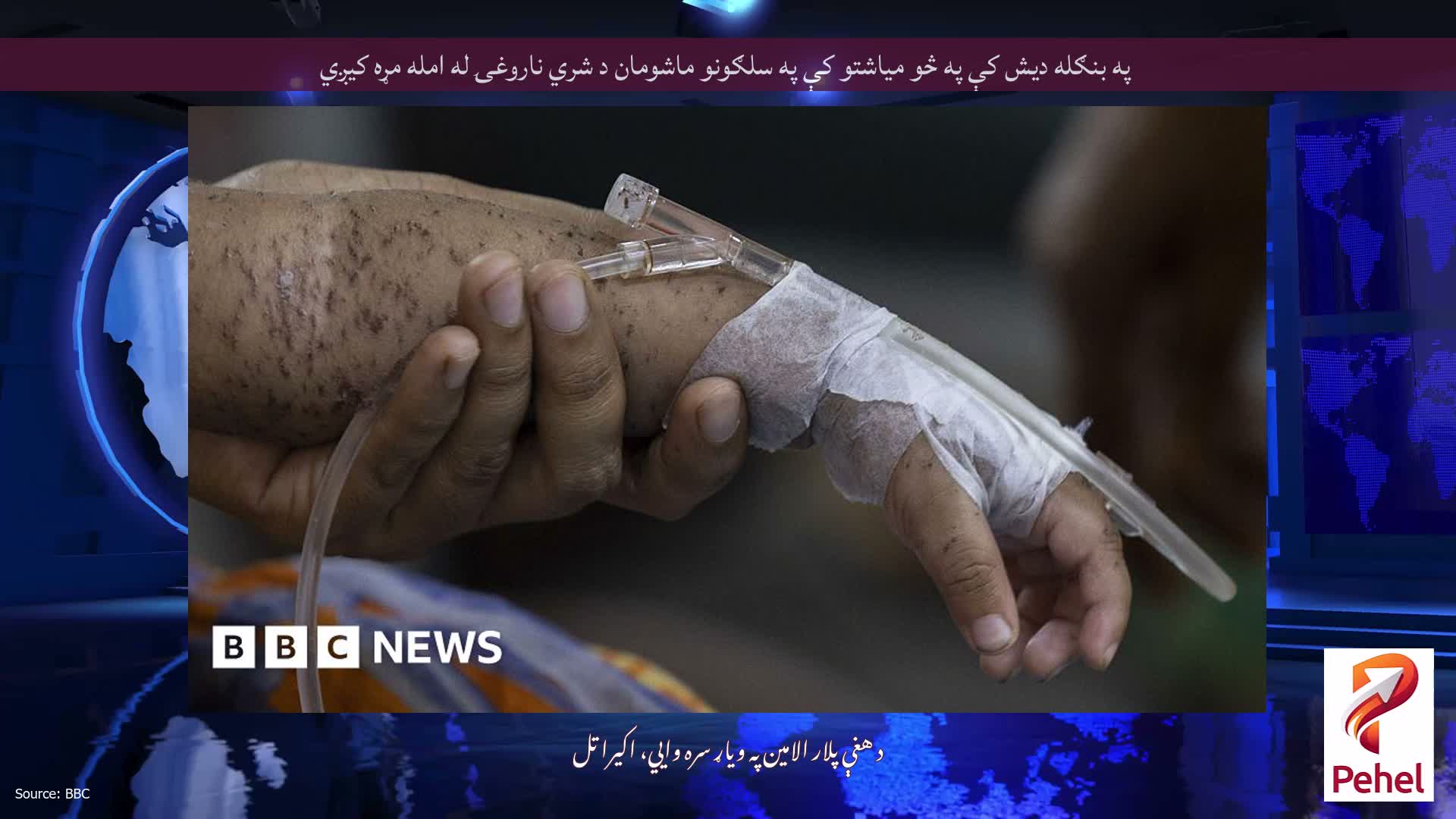 په بنګله دیش کې په څو میاشتو کې په سلګونو ماشومان د شري ناروغۍ له امله مړه کیږي