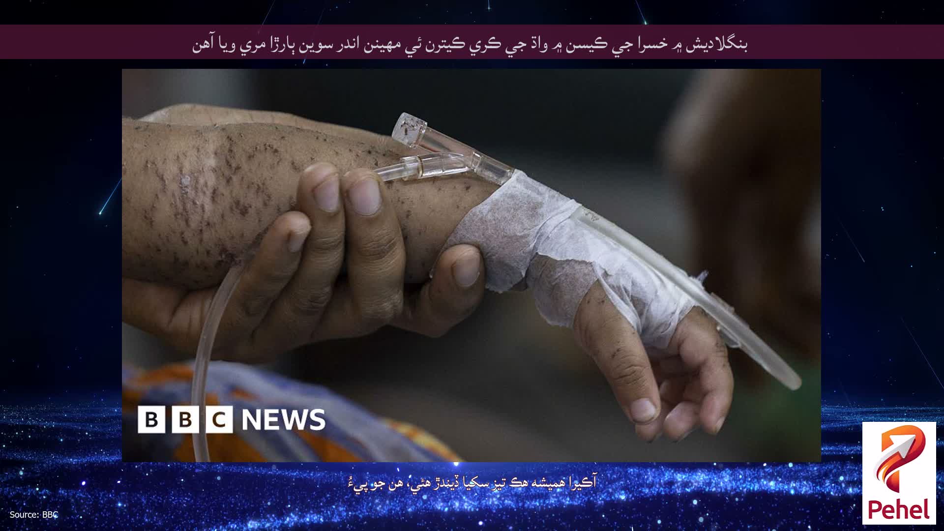 بنگلاديش ۾ خسرا جي ڪيسن ۾ واڌ جي ڪري ڪيترن ئي مهينن اندر سوين ٻارڙا مري ويا آهن