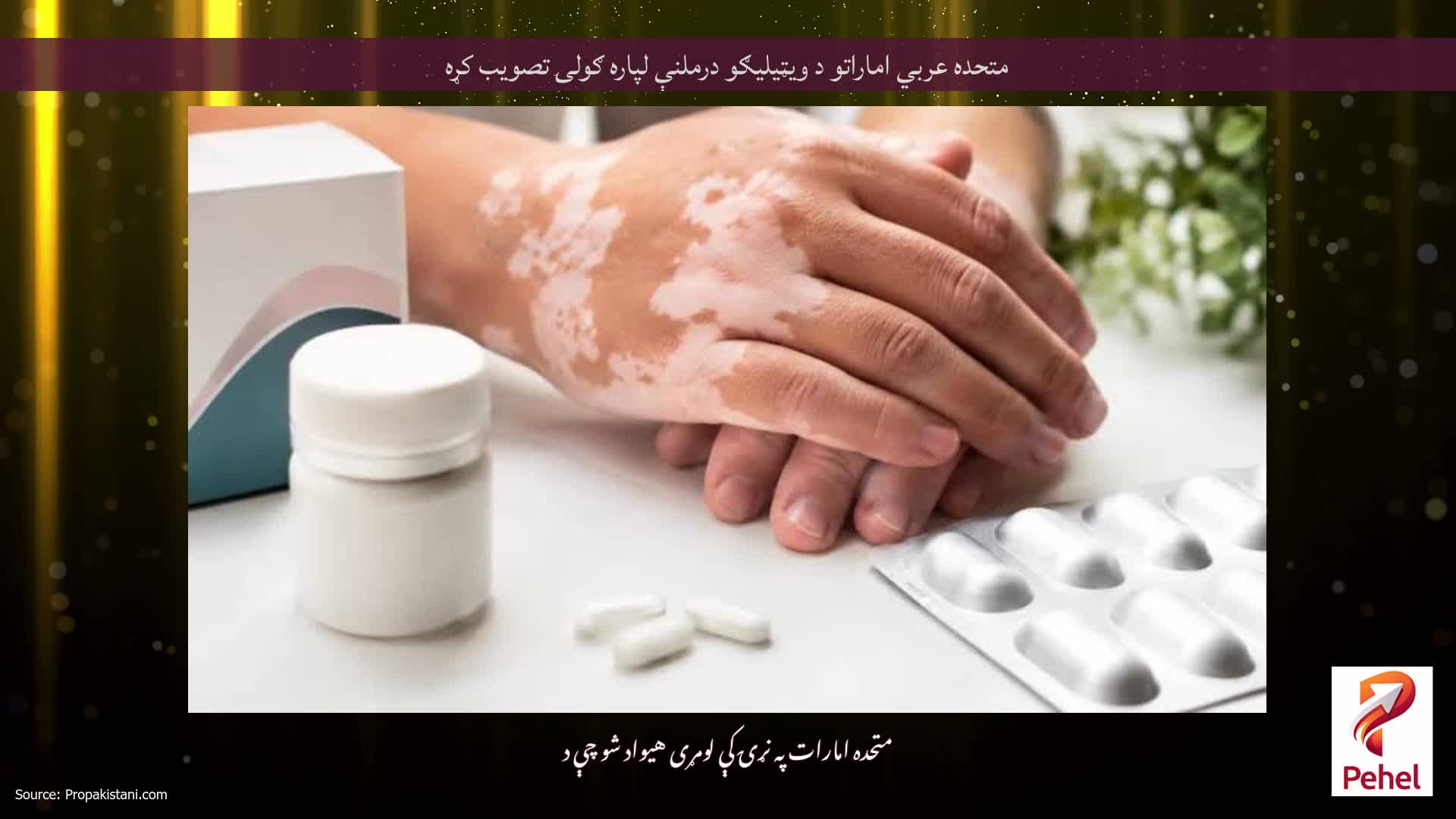 متحده عربي اماراتو د ویټیلیګو درملنې لپاره ګولۍ تصویب کړه