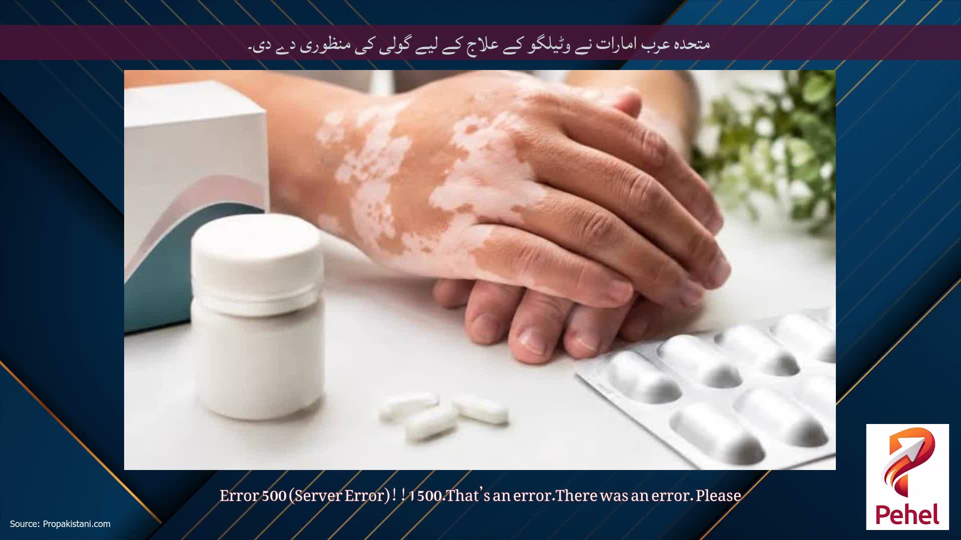 متحدہ عرب امارات نے وٹیلگو کے علاج کے لیے گولی کی منظوری دے دی۔