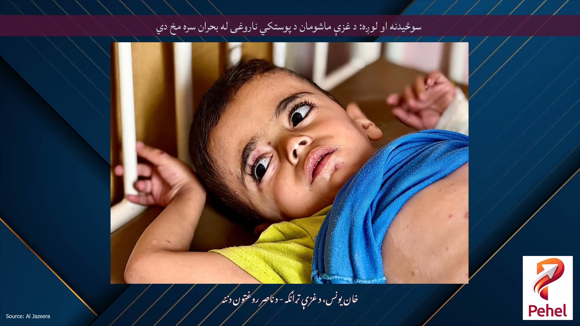 سوځیدنه او لوږه: د غزې ماشومان د پوستکي ناروغۍ له بحران سره مخ دي
