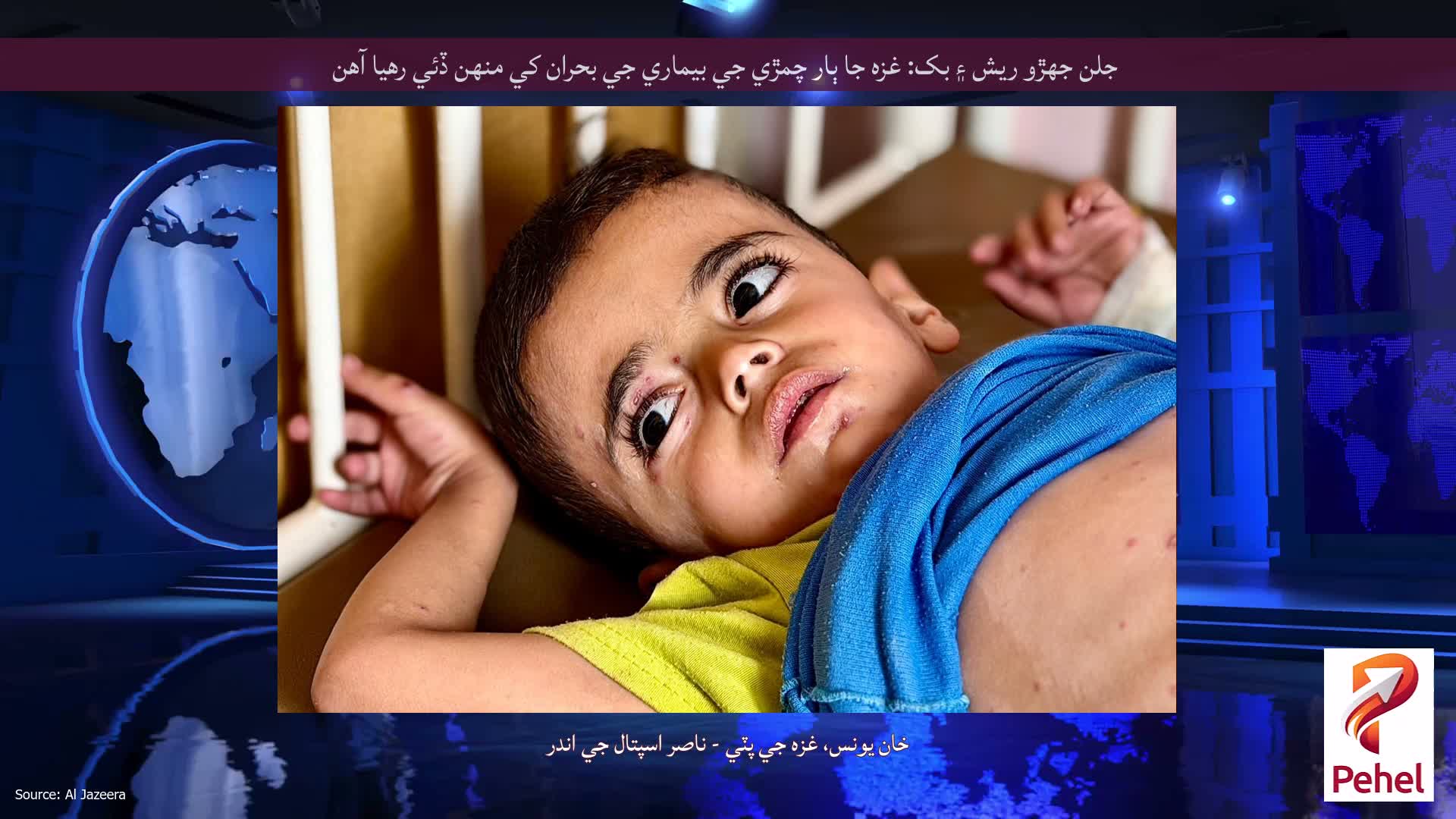 جلن جهڙو ريش ۽ بک: غزه جا ٻار چمڙي جي بيماري جي بحران کي منهن ڏئي رهيا آهن