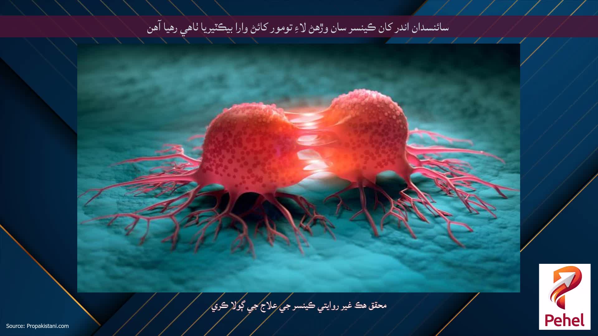 سائنسدان اندر کان ڪينسر سان وڙهڻ لاءِ تومور کائڻ وارا بيڪٽيريا ٺاهي رهيا آهن