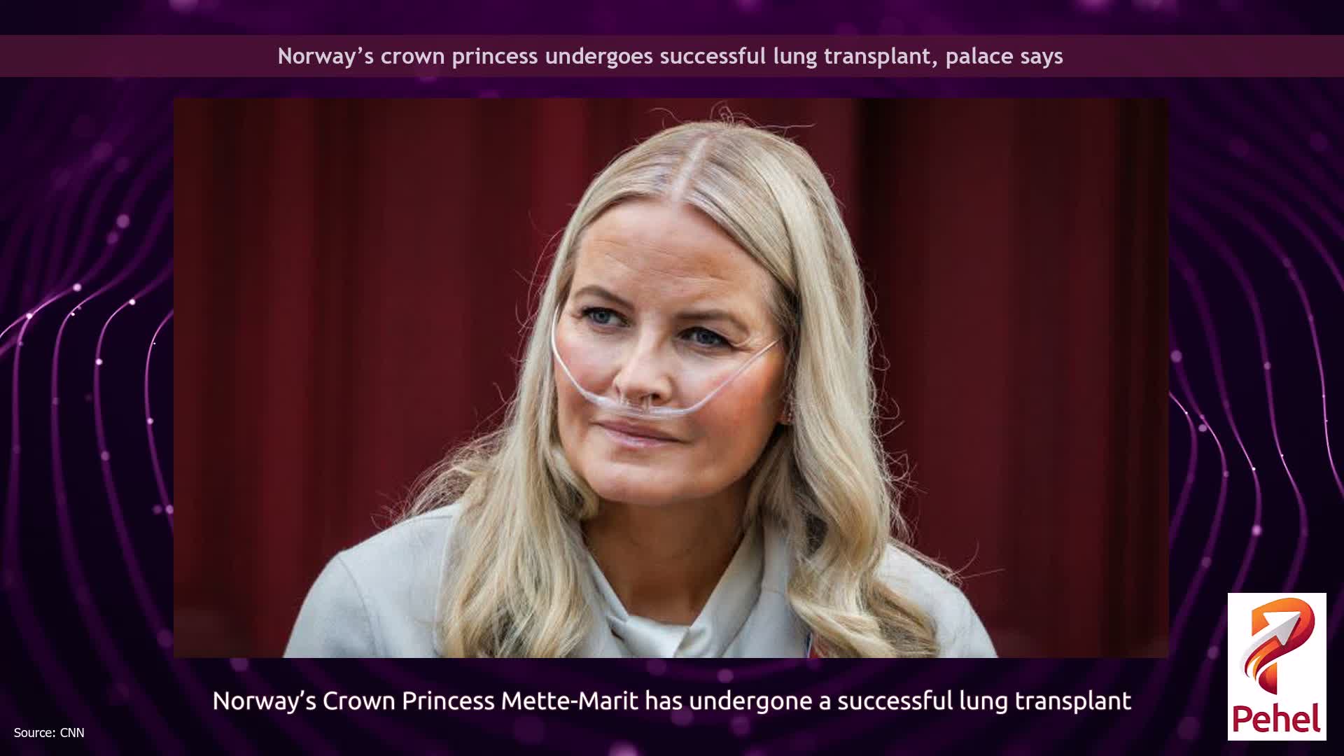 Norway’s crown princess undergoes successful lung transplant, palace says