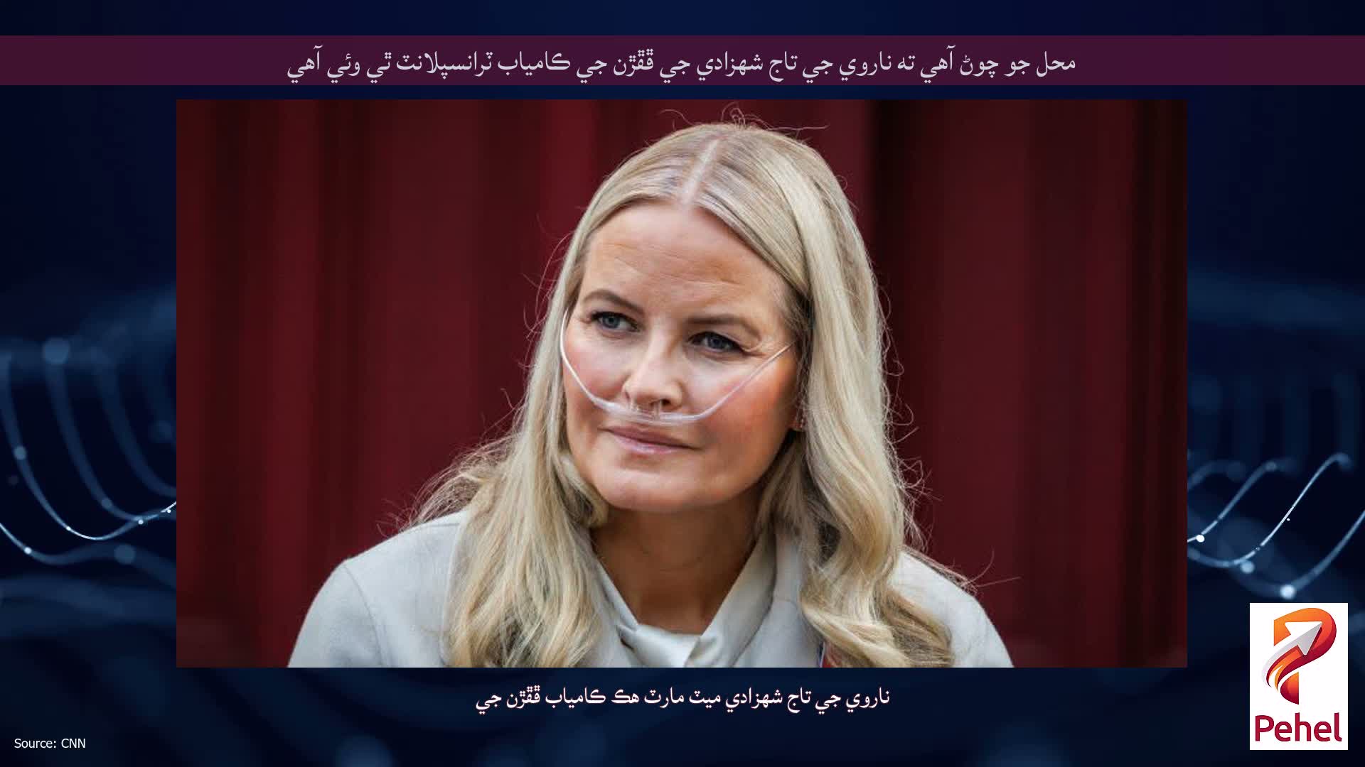 محل جو چوڻ آهي ته ناروي جي تاج شهزادي جي ڦڦڙن جي ڪامياب ٽرانسپلانٽ ٿي وئي آهي
