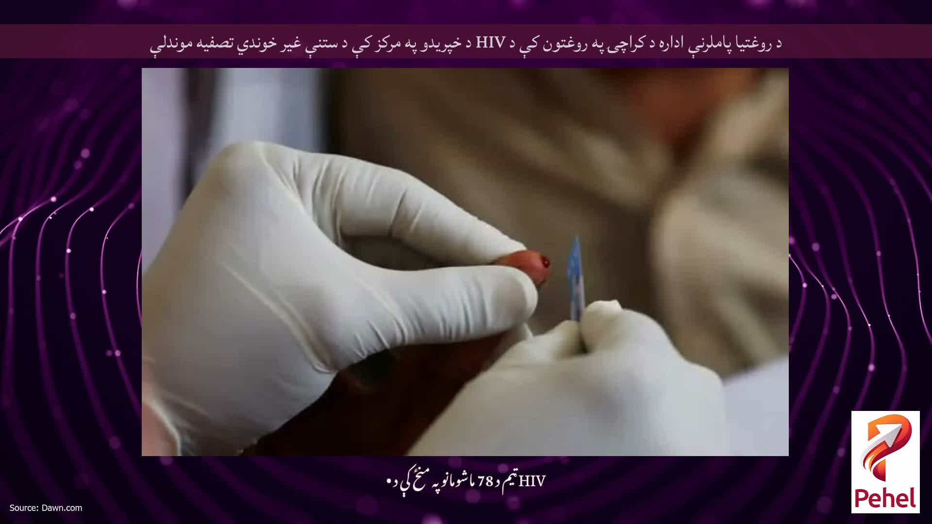 د روغتیا پاملرنې اداره د کراچۍ په روغتون کې د HIV د خپریدو په مرکز کې د ستنې غیر خوندي تصفیه موندلې