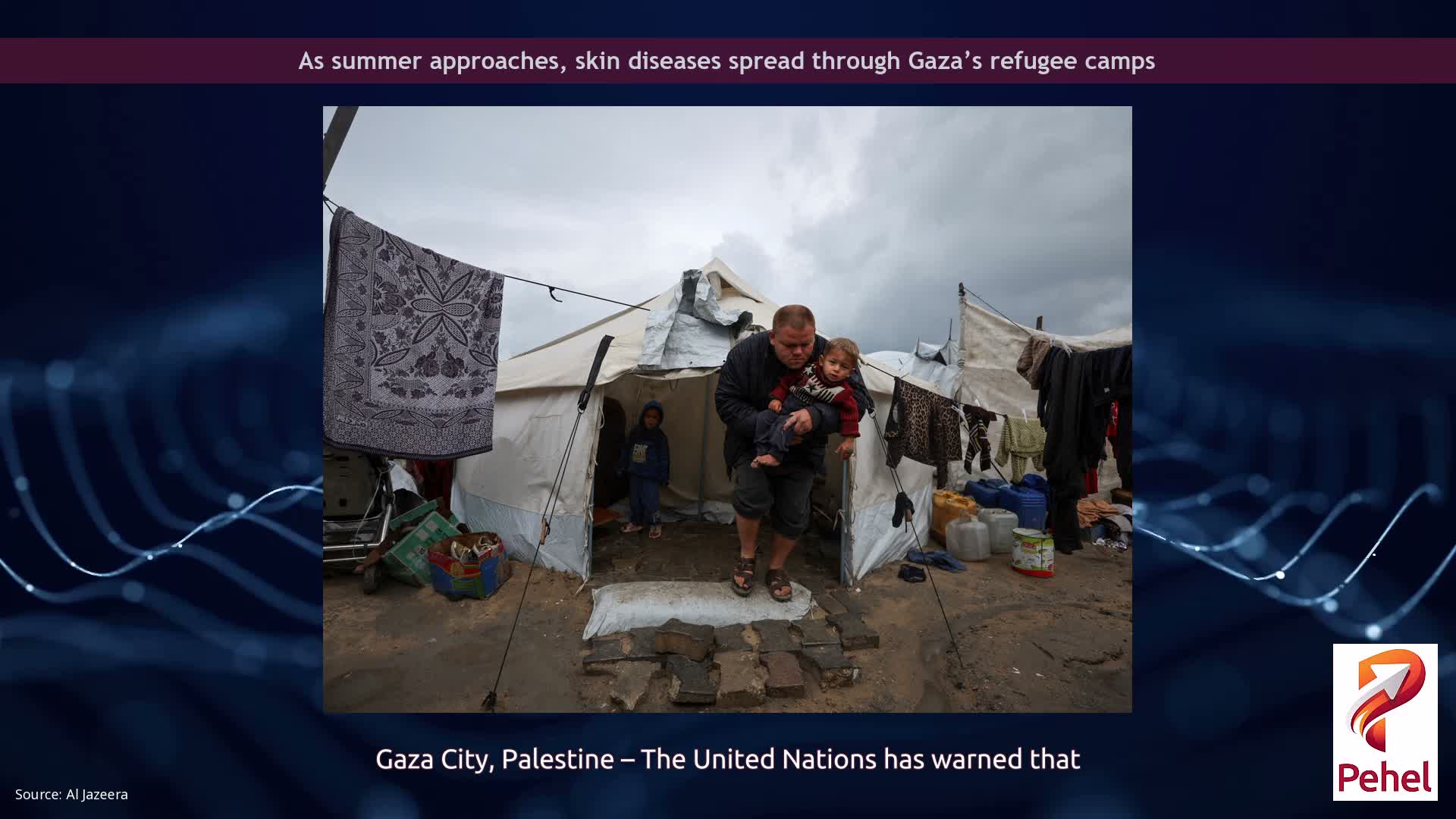 As summer approaches, skin diseases spread through Gaza’s refugee camps