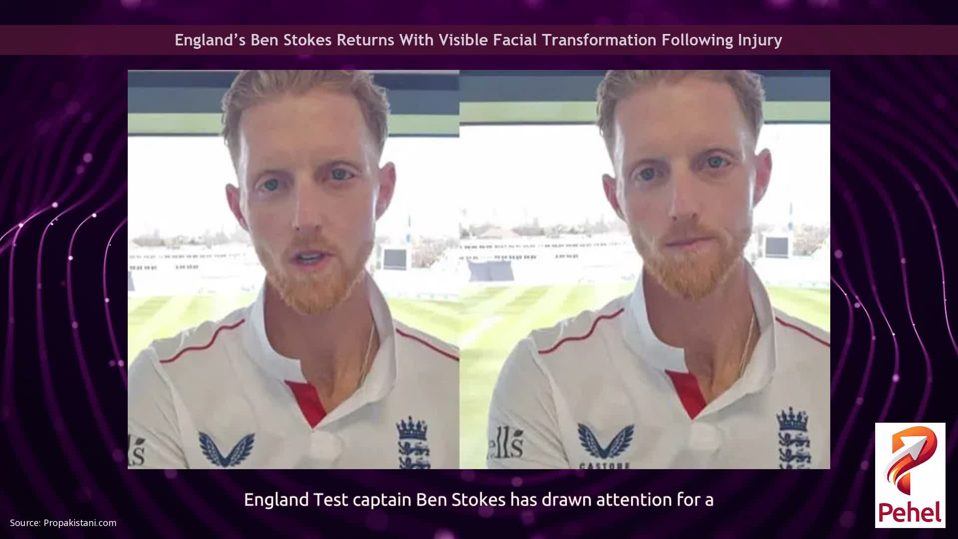 England’s Ben Stokes Returns With Visible Facial Transformation Following Injury