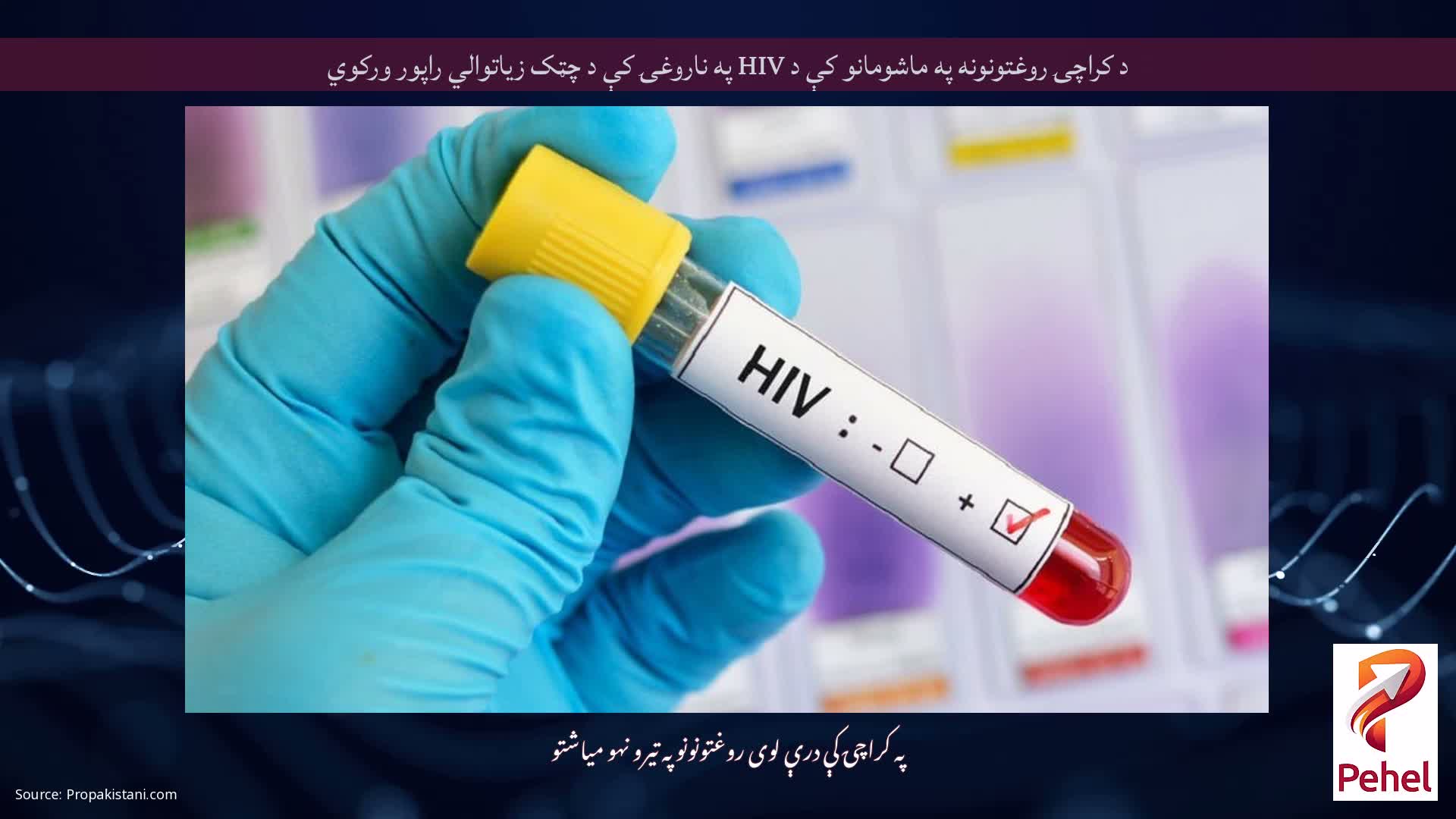 د کراچۍ روغتونونه په ماشومانو کې د HIV په ناروغۍ کې د چټک زیاتوالي راپور ورکوي