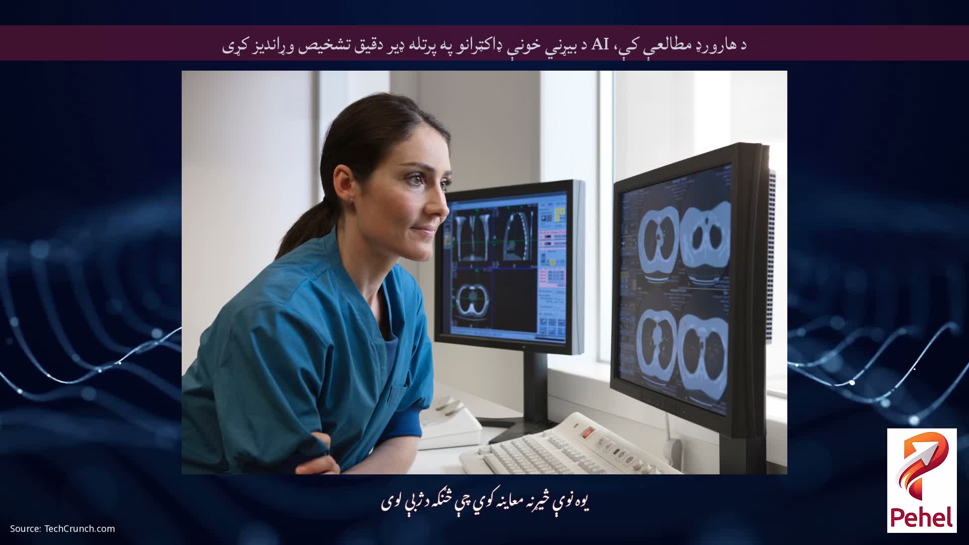د هارورډ مطالعې کې، AI د بیړني خونې ډاکټرانو په پرتله ډیر دقیق تشخیص وړاندیز کړی