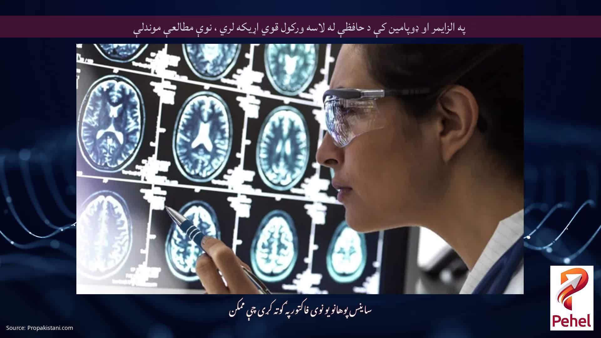 په الزایمر او ډوپامین کې د حافظې له لاسه ورکول قوي اړیکه لري ، نوې مطالعې موندلې