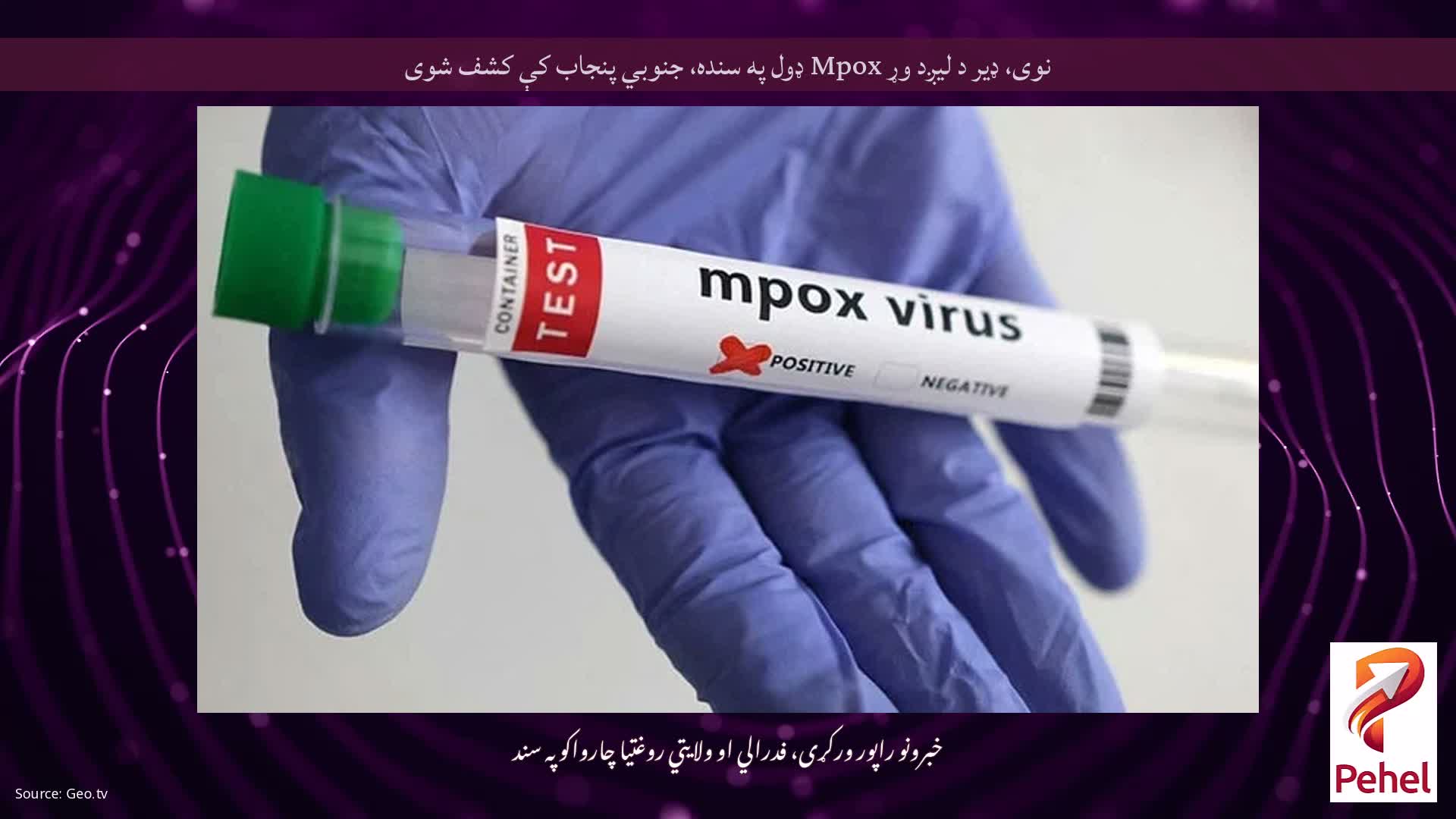 نوی، ډیر د لیږد وړ Mpox ډول په سنده، جنوبي پنجاب کې کشف شوی