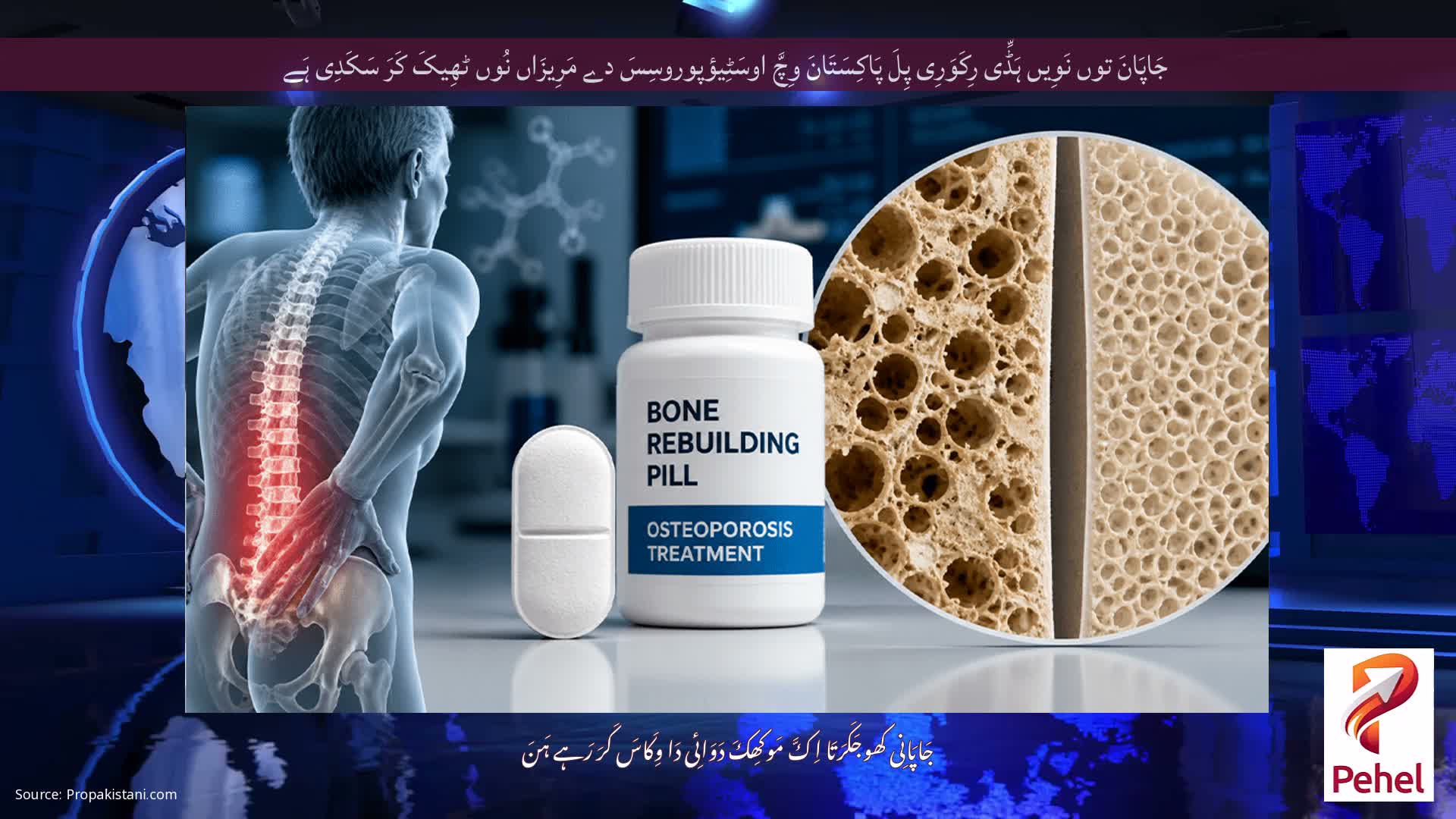 جَاپَانَ توں نَوِیں ہَڈِّی رِکَوَرِی پِلَ پَاکِسَتَانَ وِچَّ اوسَٹِیؤپوروسِسَ دے مَرِیزَاں نُوں ٹھِیکَ کَرَ سَکَدِی ہَے