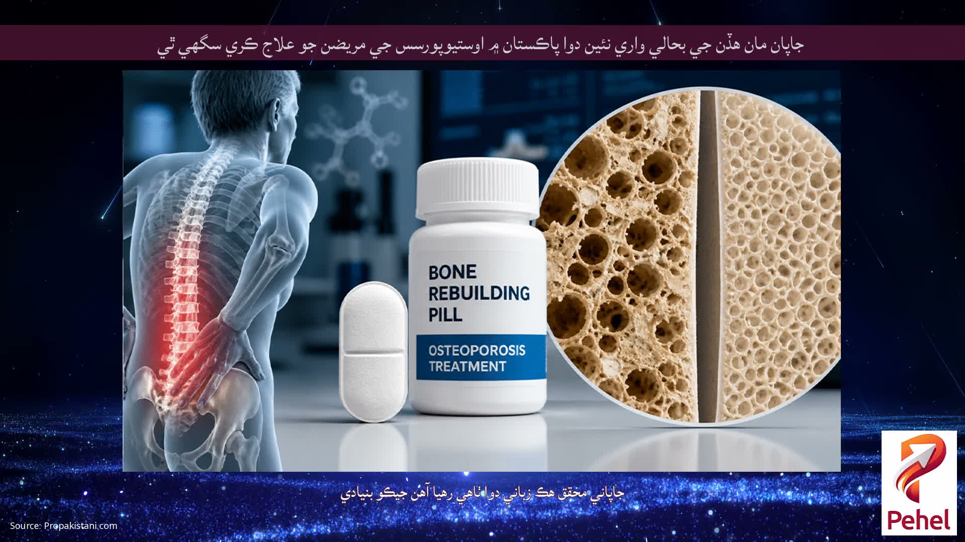 جاپان مان هڏن جي بحالي واري نئين دوا پاڪستان ۾ اوستيوپورسس جي مريضن جو علاج ڪري سگهي ٿي