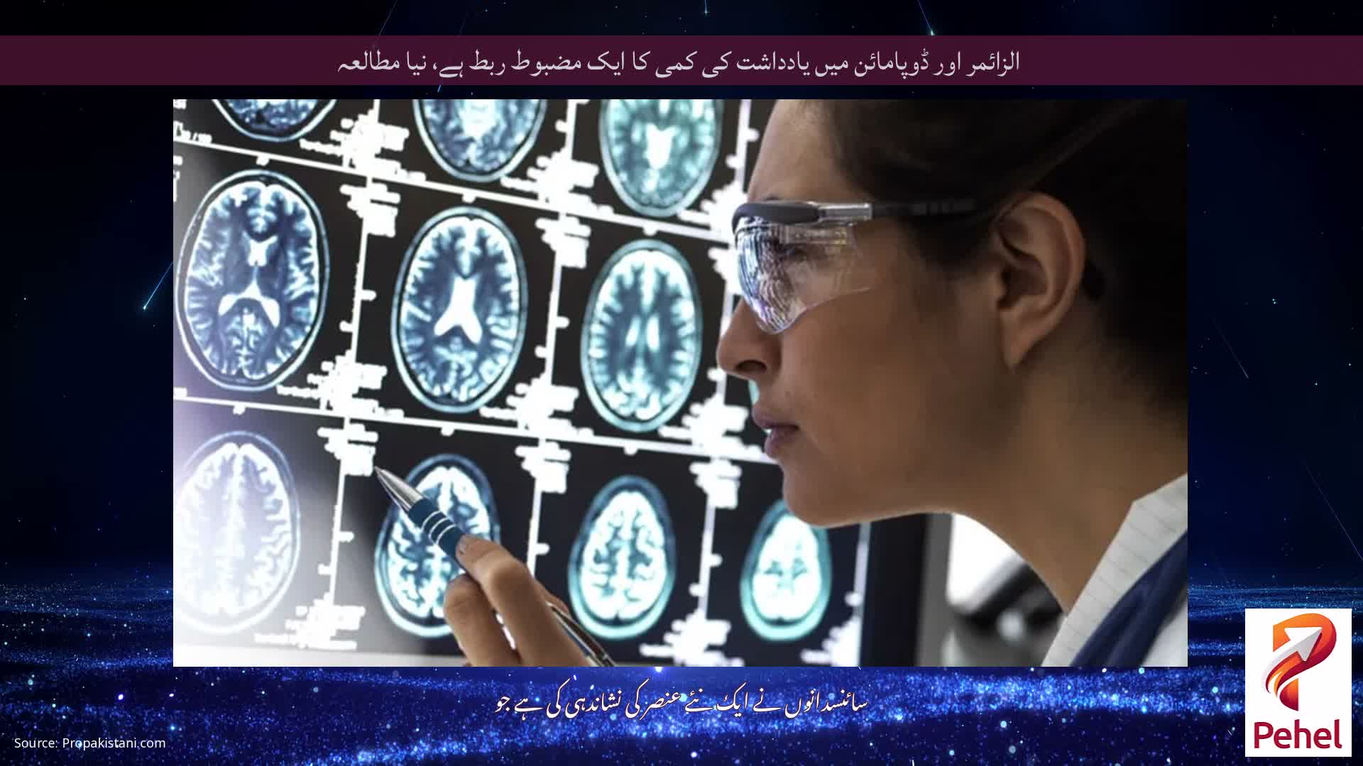 الزائمر اور ڈوپامائن میں یادداشت کی کمی کا ایک مضبوط ربط ہے، نیا مطالعہ