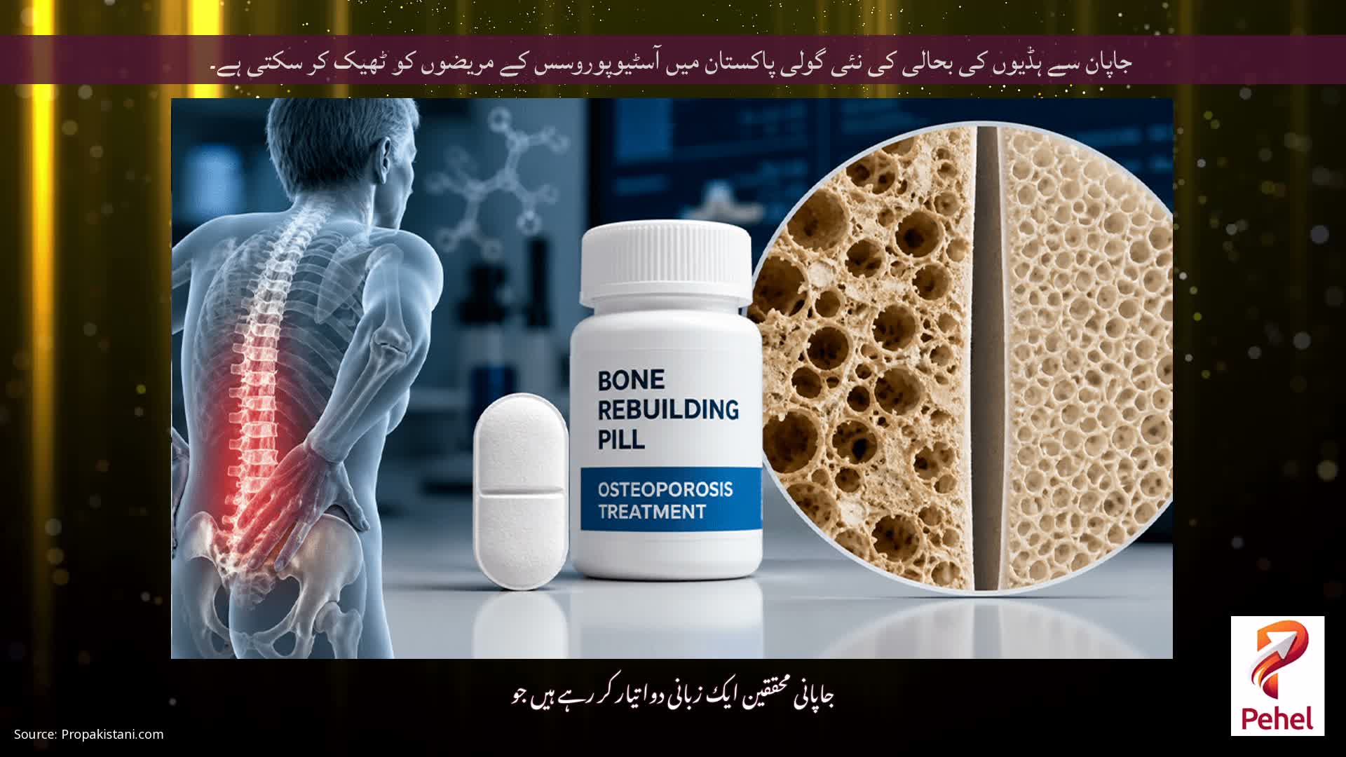 جاپان سے ہڈیوں کی بحالی کی نئی گولی پاکستان میں آسٹیوپوروسس کے مریضوں کو ٹھیک کر سکتی ہے۔