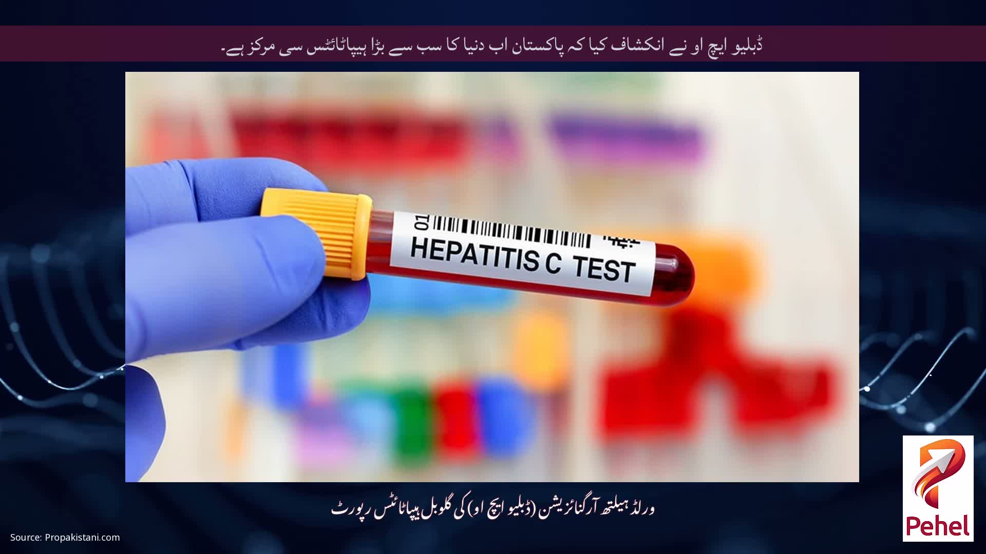 ڈبلیو ایچ او نے انکشاف کیا کہ پاکستان اب دنیا کا سب سے بڑا ہیپاٹائٹس سی مرکز ہے۔