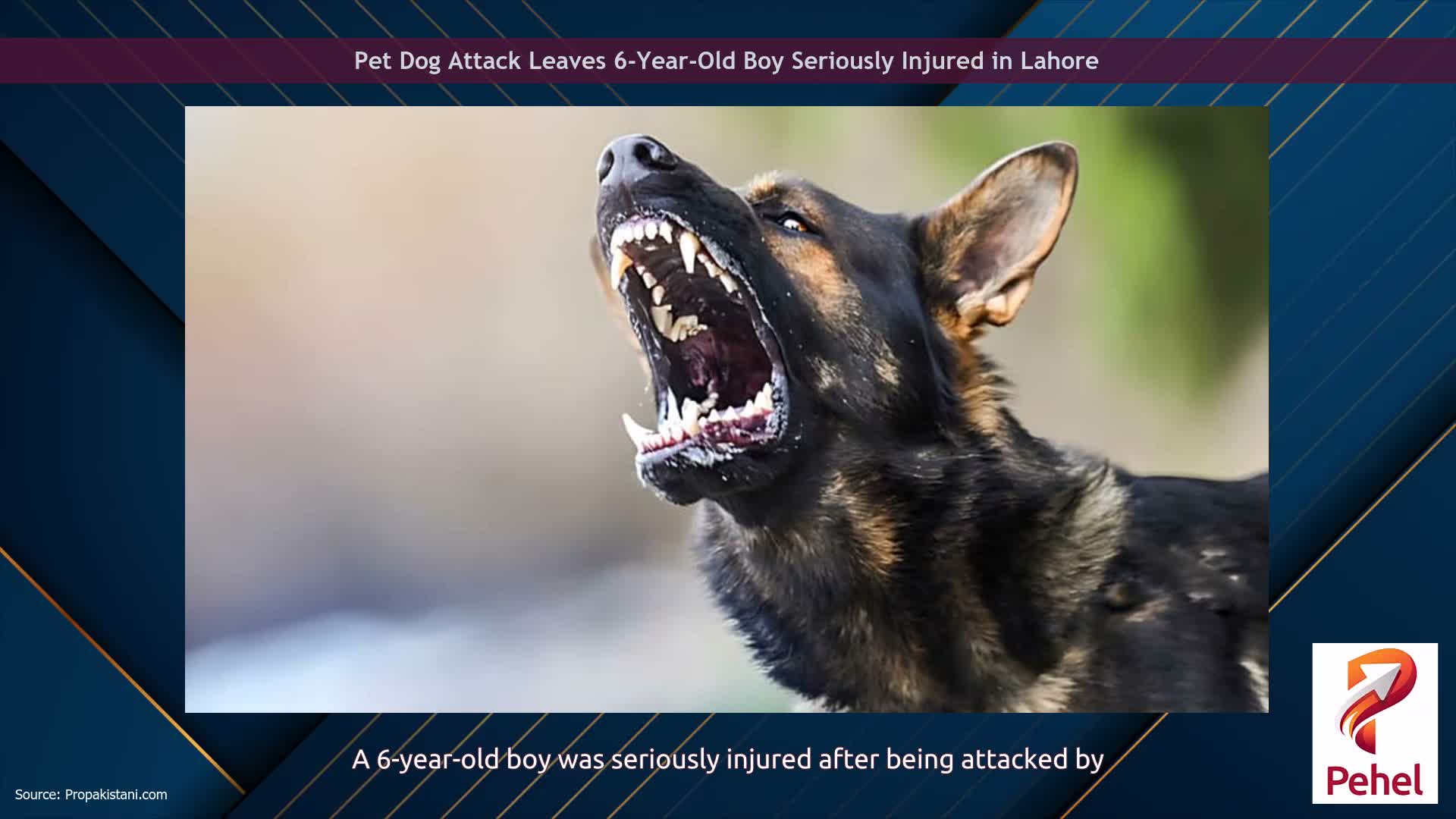 Pet Dog Attack Leaves 6-Year-Old Boy Seriously Injured in Lahore