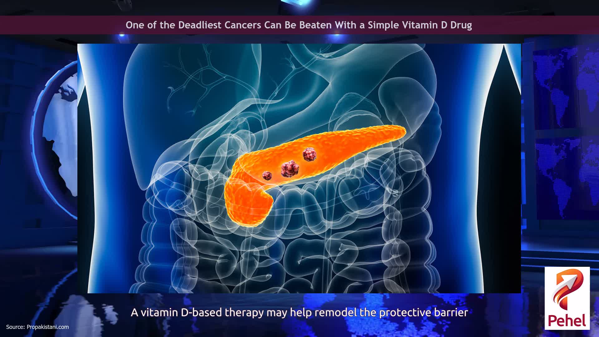 One of the Deadliest Cancers Can Be Beaten With a Simple Vitamin D Drug