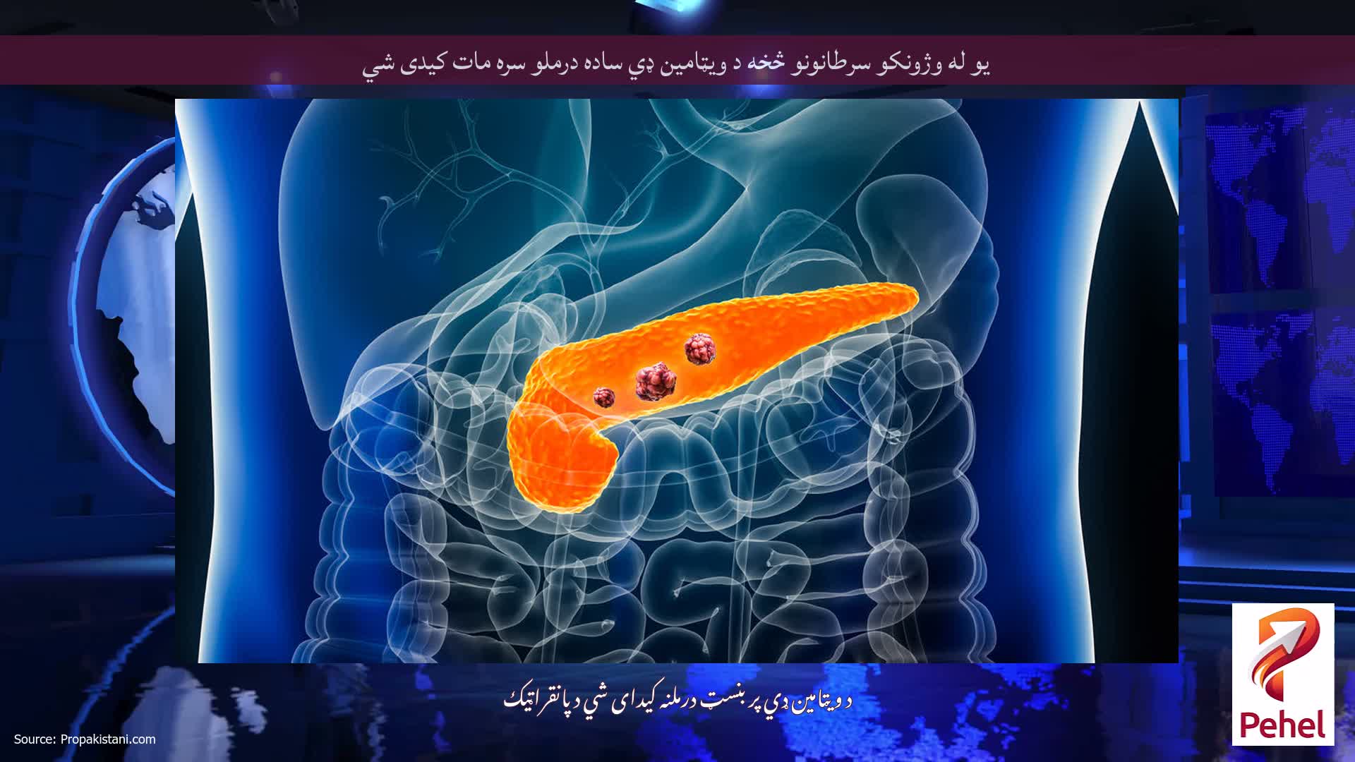 یو له وژونکو سرطانونو څخه د ویټامین ډي ساده درملو سره مات کیدی شي
