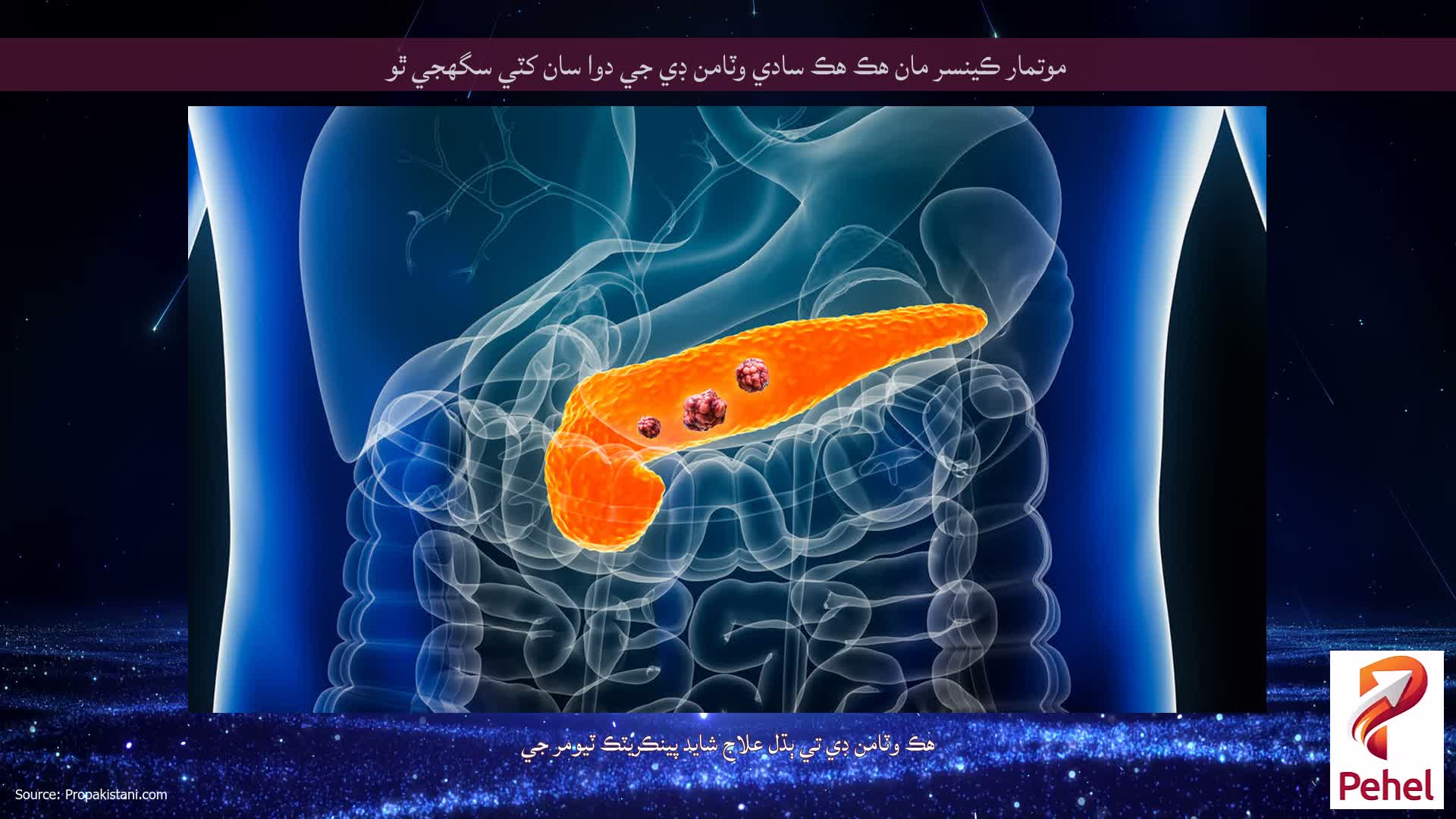 موتمار ڪينسر مان هڪ هڪ سادي وٽامن ڊي جي دوا سان کٽي سگهجي ٿو