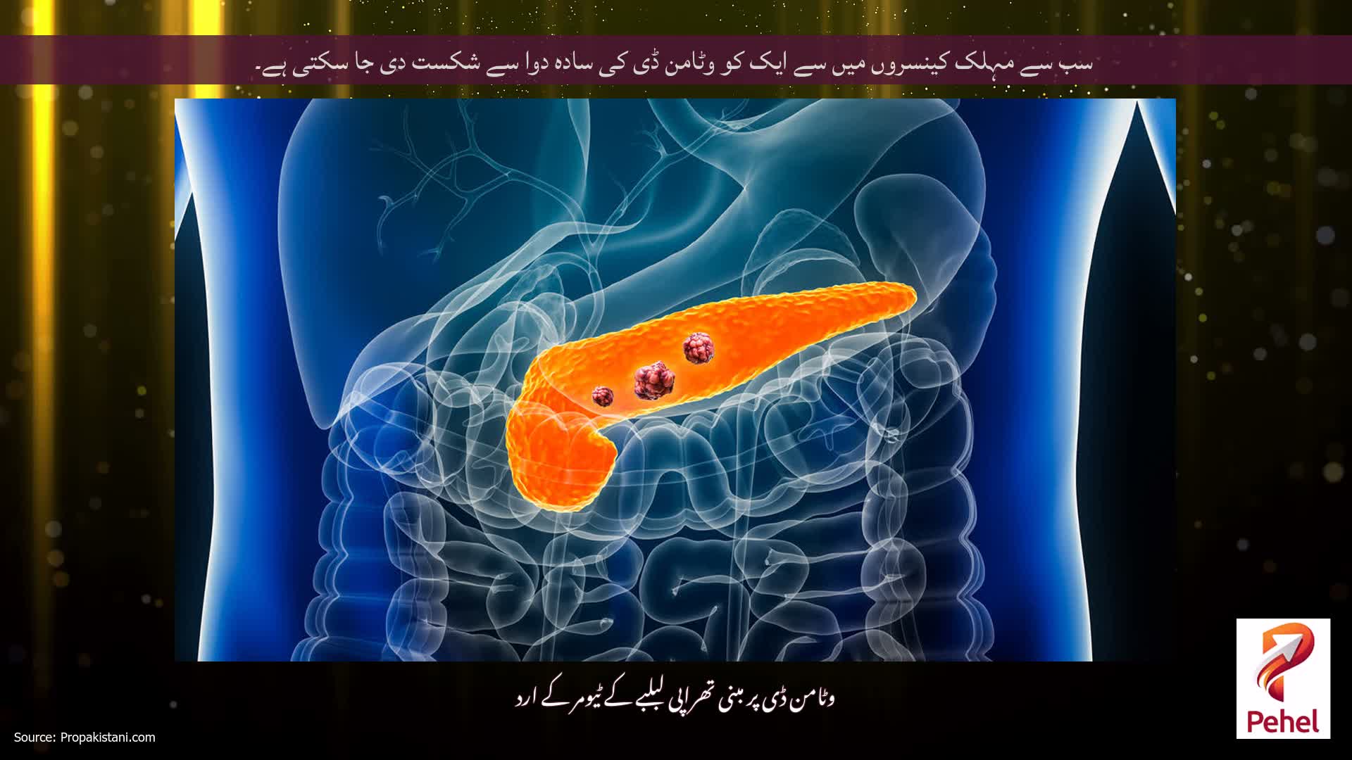 سب سے مہلک کینسروں میں سے ایک کو وٹامن ڈی کی سادہ دوا سے شکست دی جا سکتی ہے۔