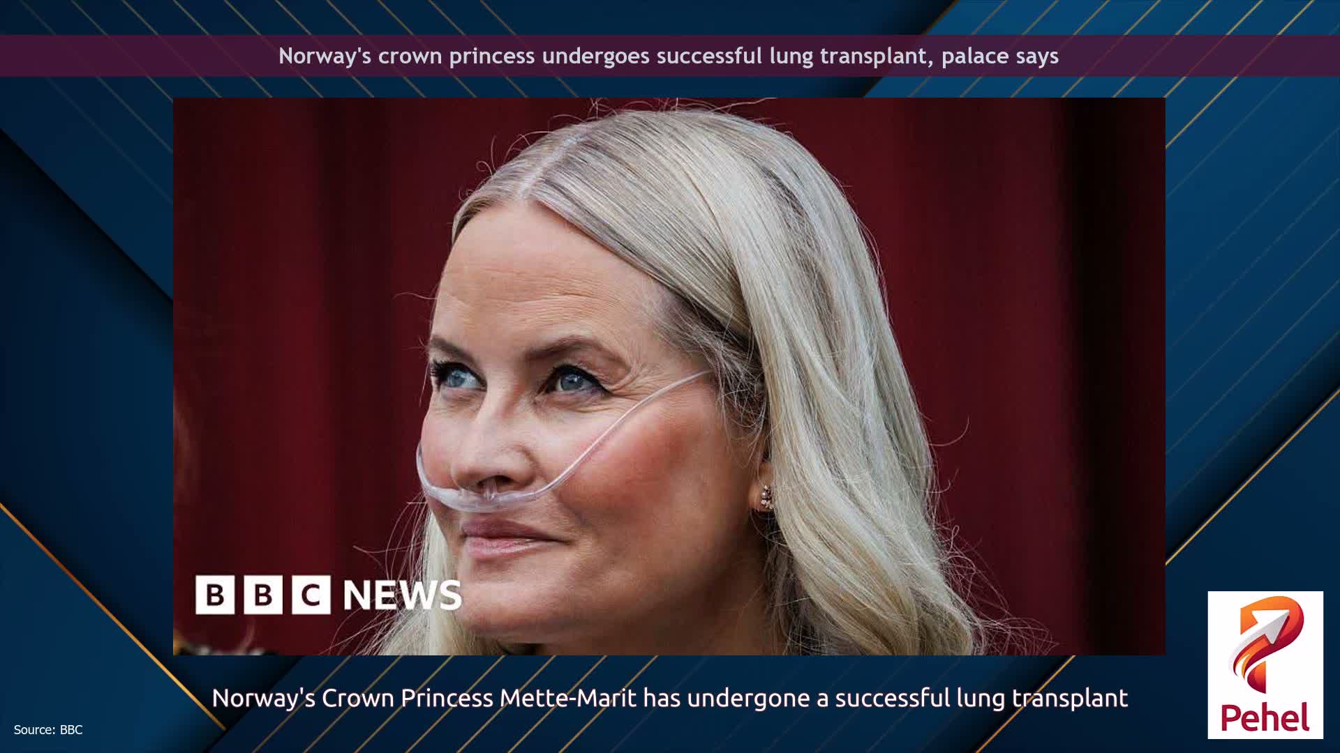 Norway's crown princess undergoes successful lung transplant, palace says