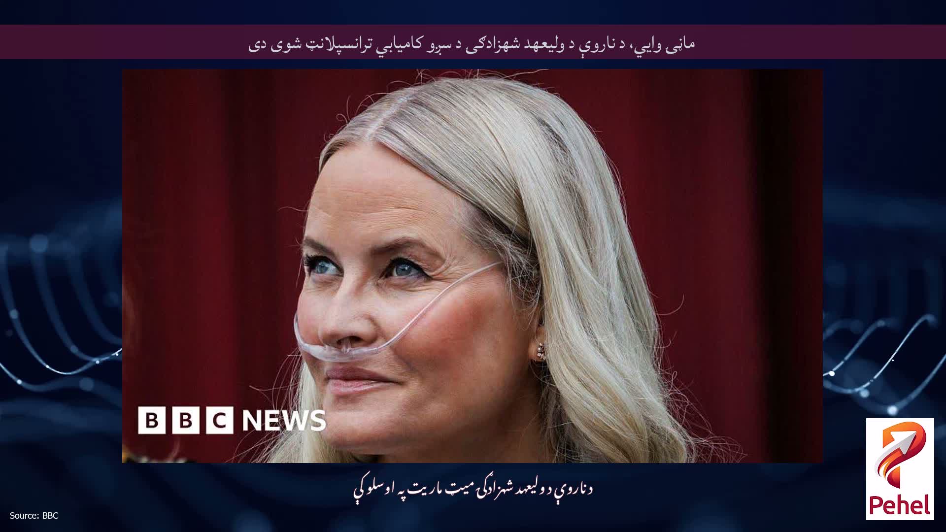 ماڼۍ وايي، د ناروې د ولیعهد شهزادګۍ د سږو کامیابي ترانسپلانټ شوی دی