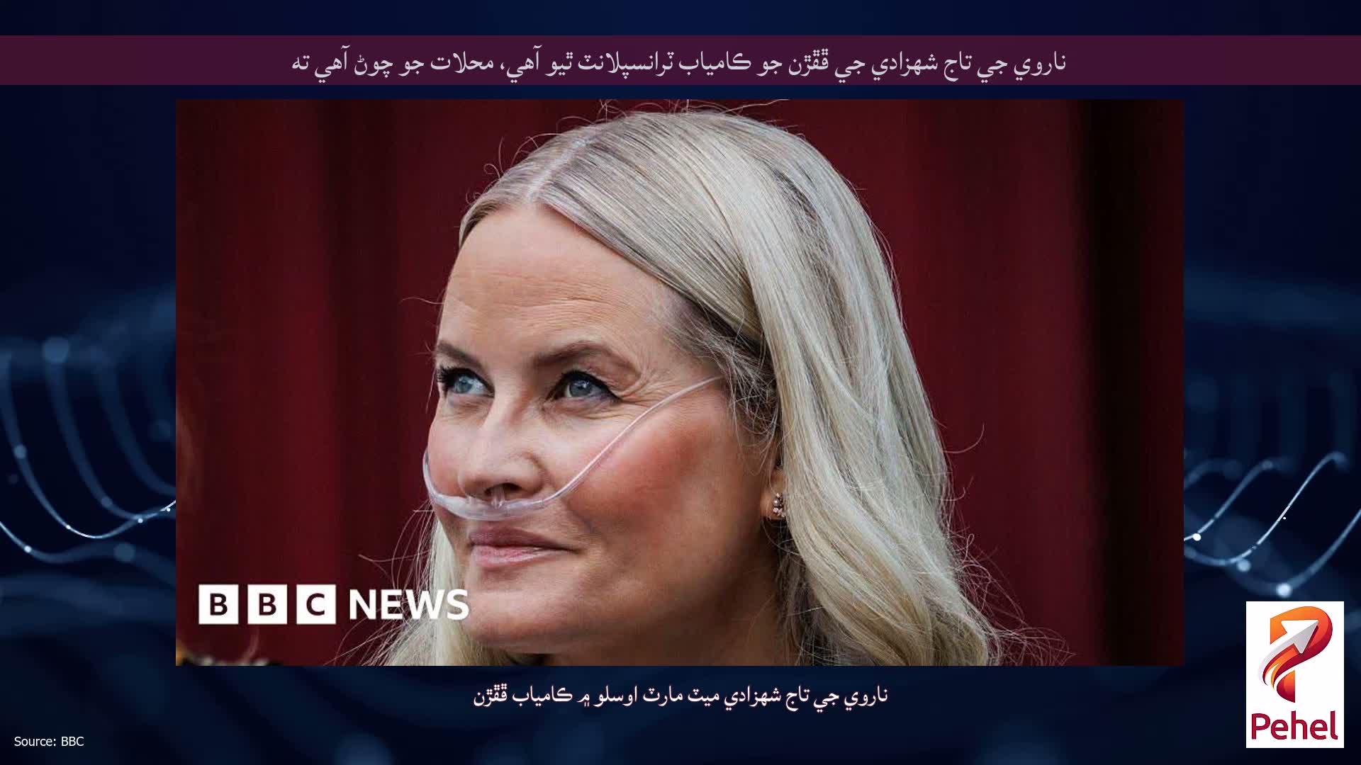 ناروي جي تاج شهزادي جي ڦڦڙن جو ڪامياب ٽرانسپلانٽ ٿيو آهي، محلات جو چوڻ آهي ته