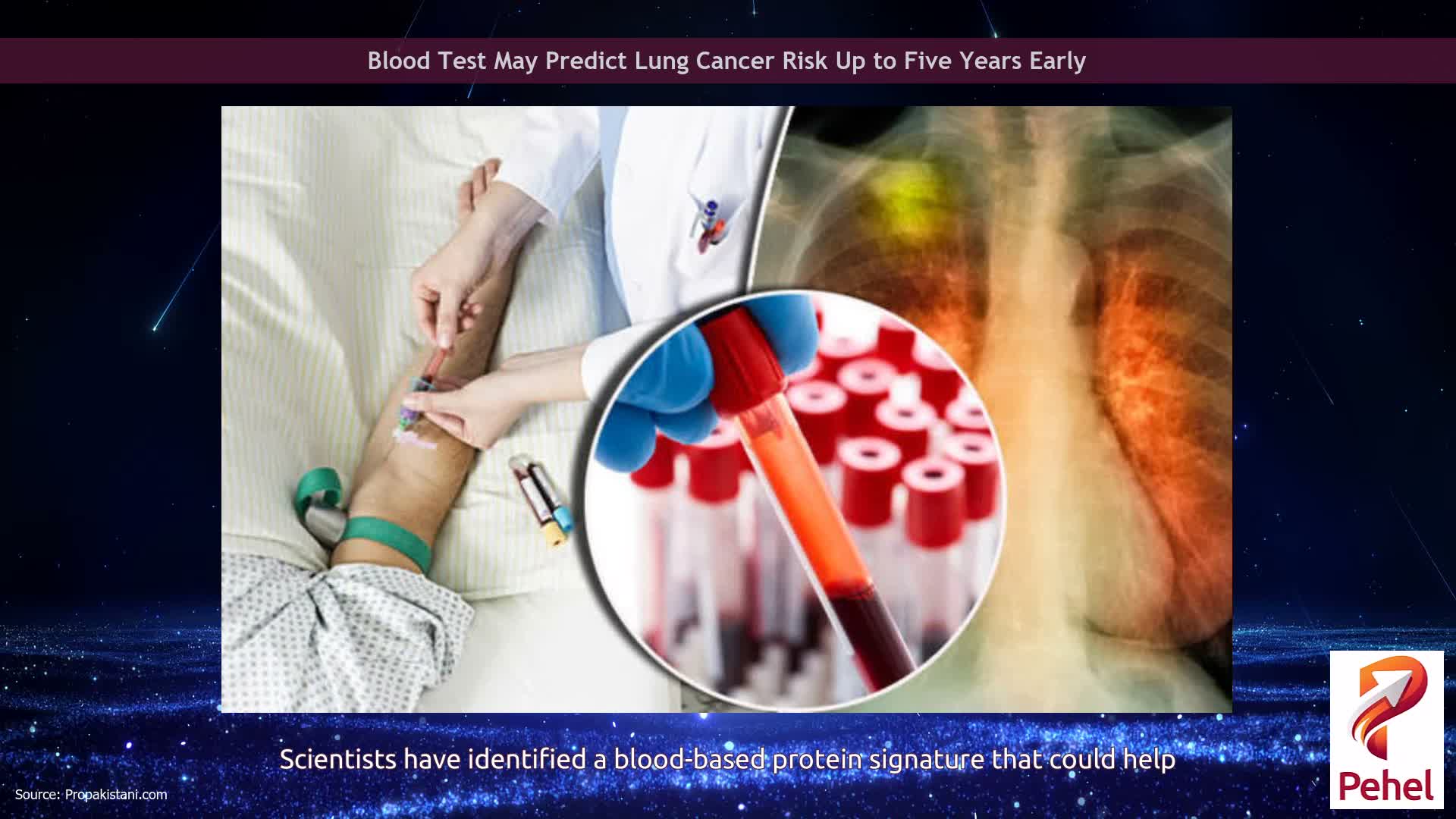 Blood Test May Predict Lung Cancer Risk Up to Five Years Early