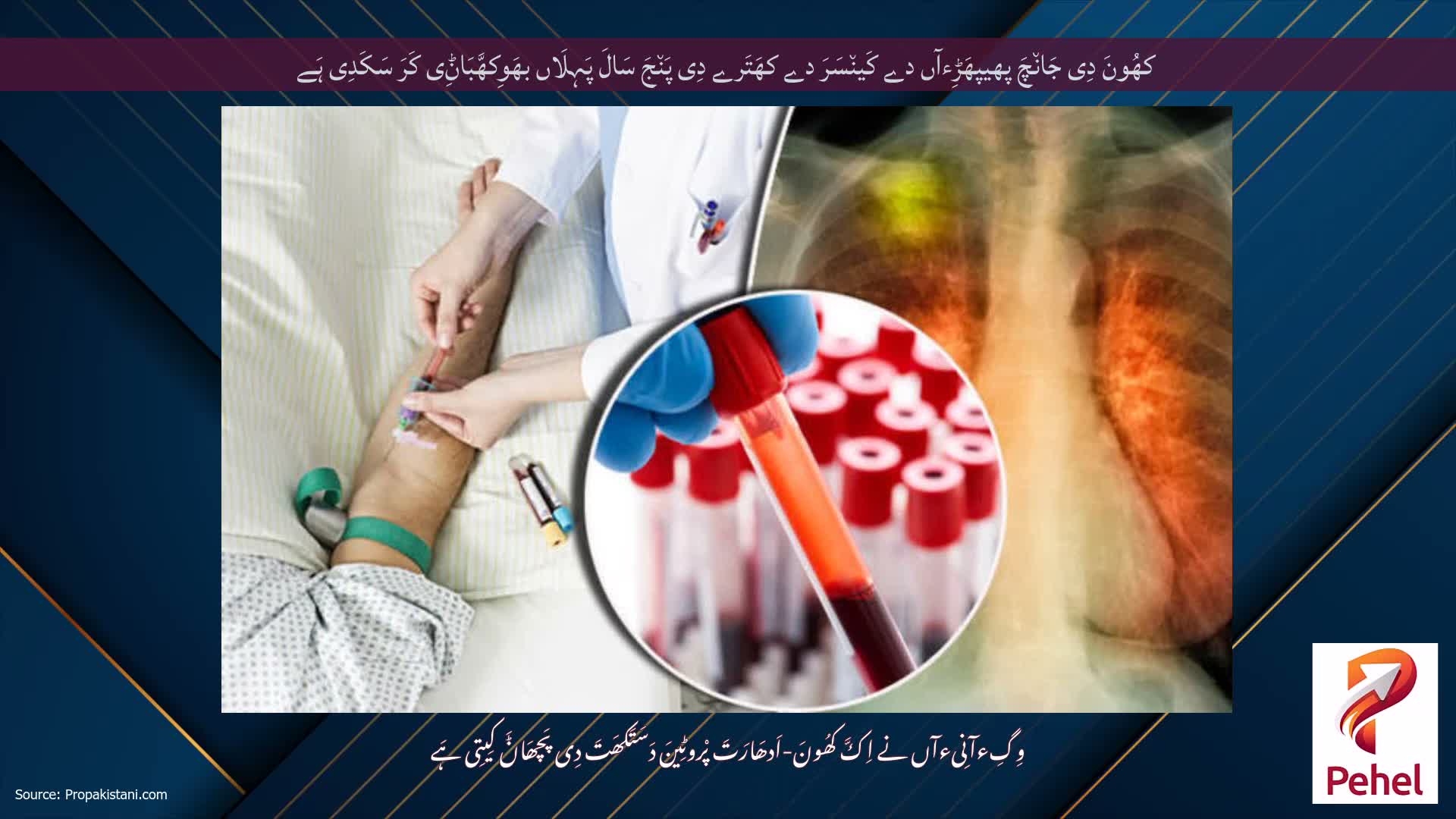 کھُونَ دِی جَان٘چَ پھیپھَڑِءآں دے کَین٘سَرَ دے کھَتَرے دِی پَن٘جَ سَالَ پَہِلَاں بھَوِکھَّبَاݨِی کَرَ سَکَدِی ہَے
