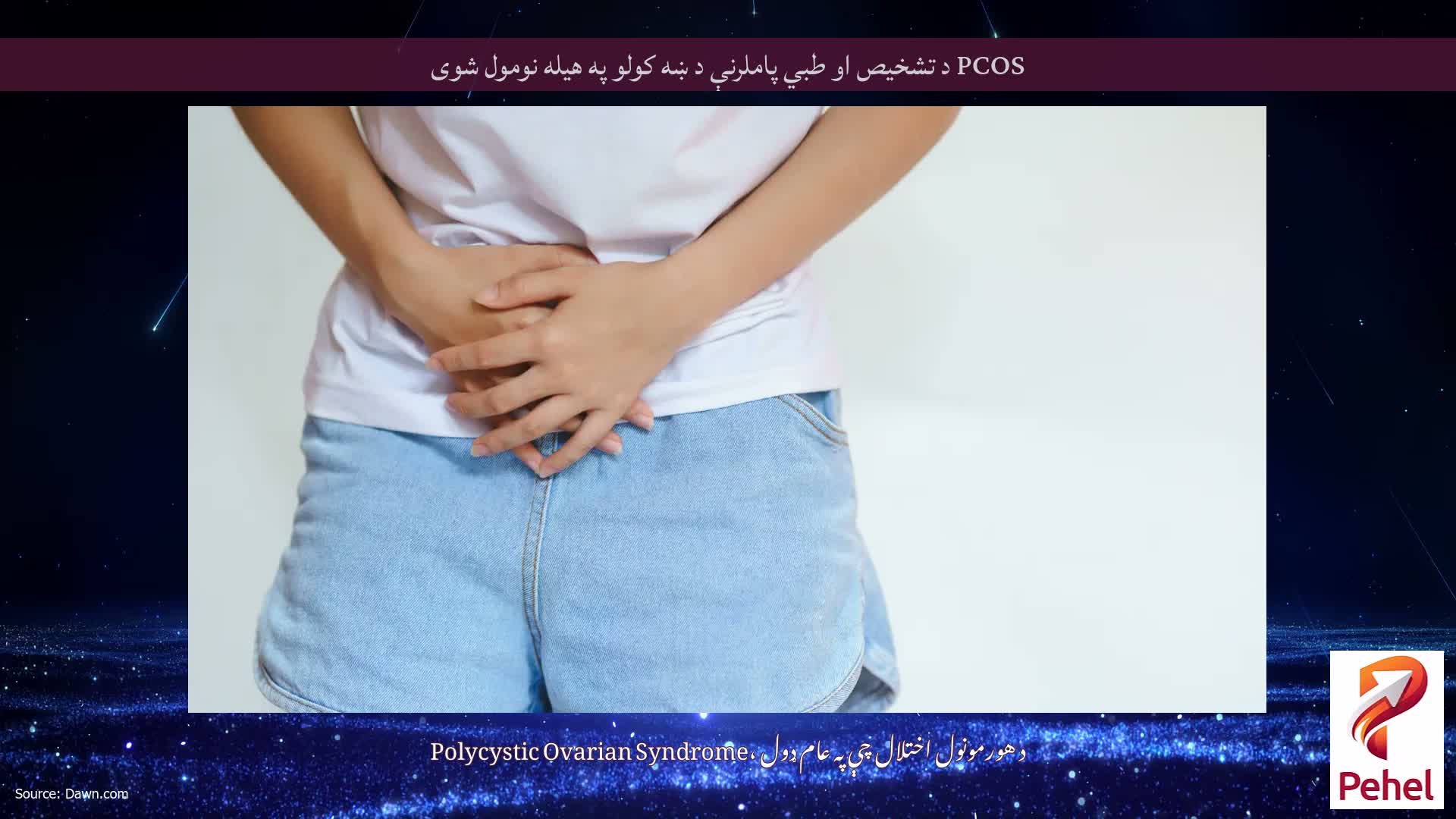 PCOS د تشخیص او طبي پاملرنې د ښه کولو په هیله نومول شوی