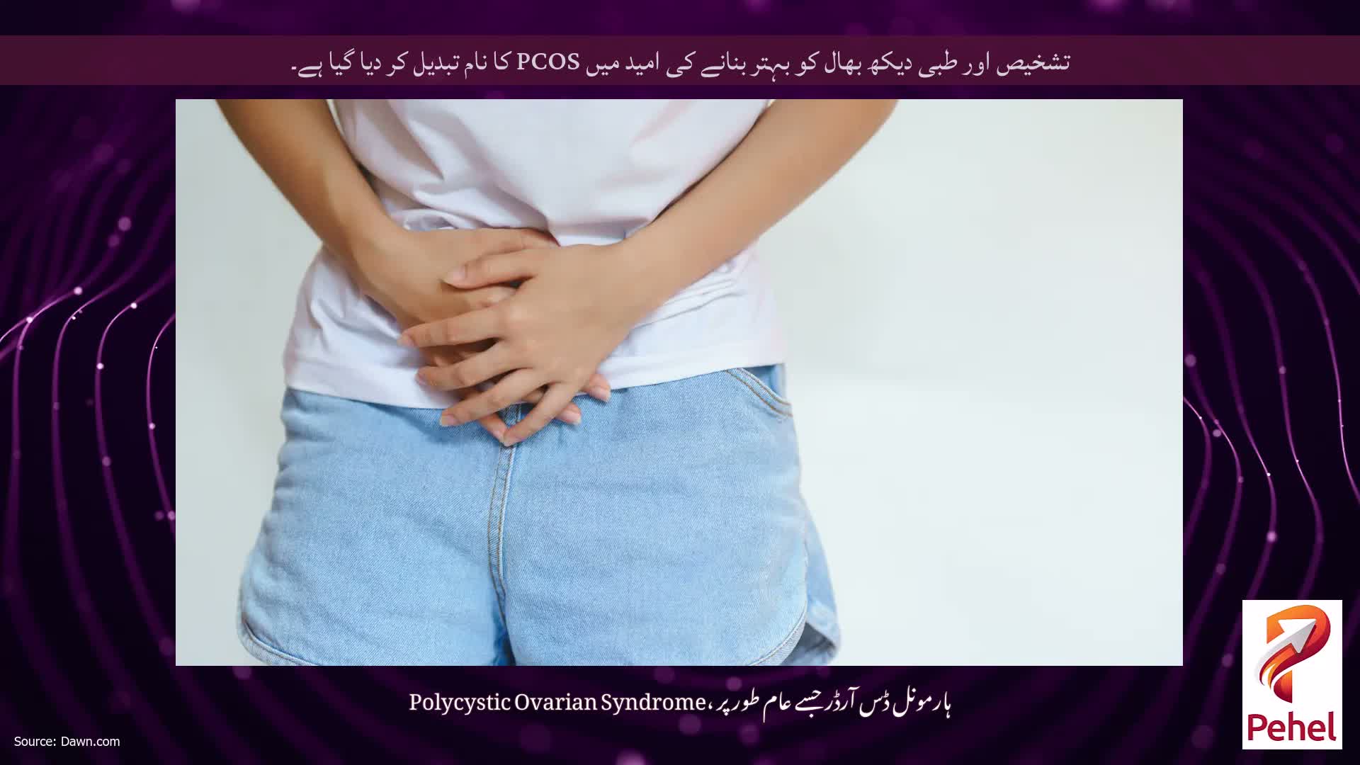 تشخیص اور طبی دیکھ بھال کو بہتر بنانے کی امید میں PCOS کا نام تبدیل کر دیا گیا ہے۔