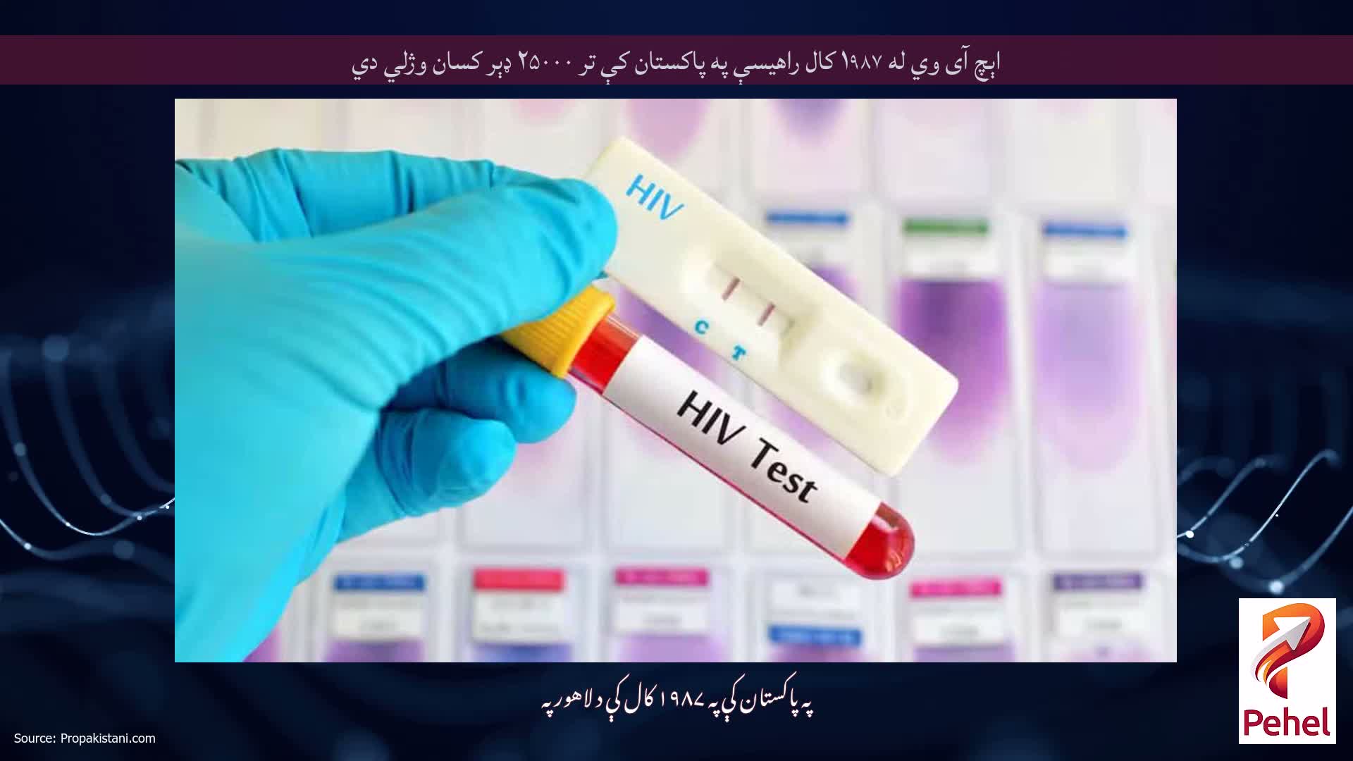 اېچ آی وي له ۱۹۸۷ کال راهیسې په پاکستان کې تر ۲۵۰۰۰ ډېر کسان وژلي دي
