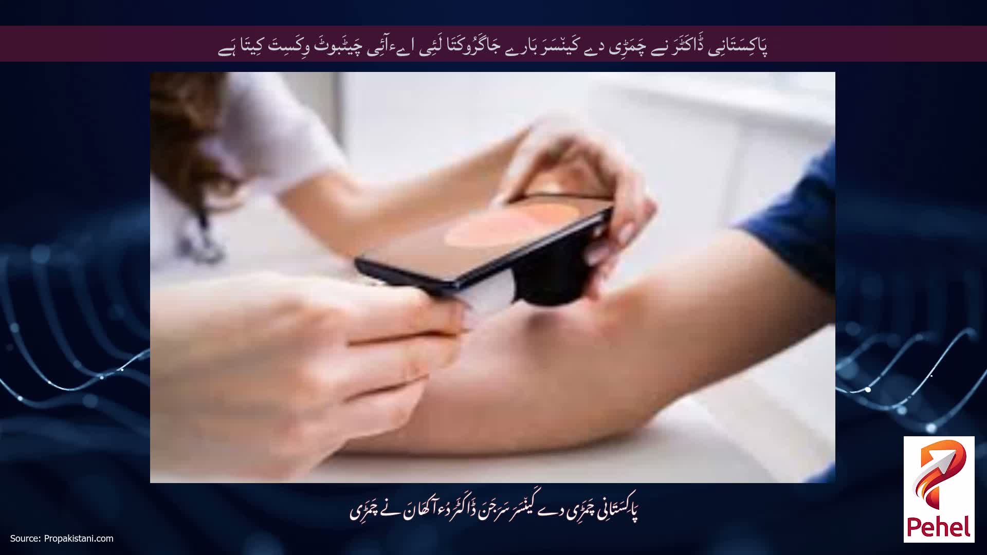 پَاکِسَتَانِی ڈَاکَٹَرَ نے چَمَڑِی دے کَین٘سَرَ بَارے جَاگَرُوکَتَا لَئِی اےءآئِی چَیٹَبوٹَ وِکَسِتَ کِیتَا ہَے