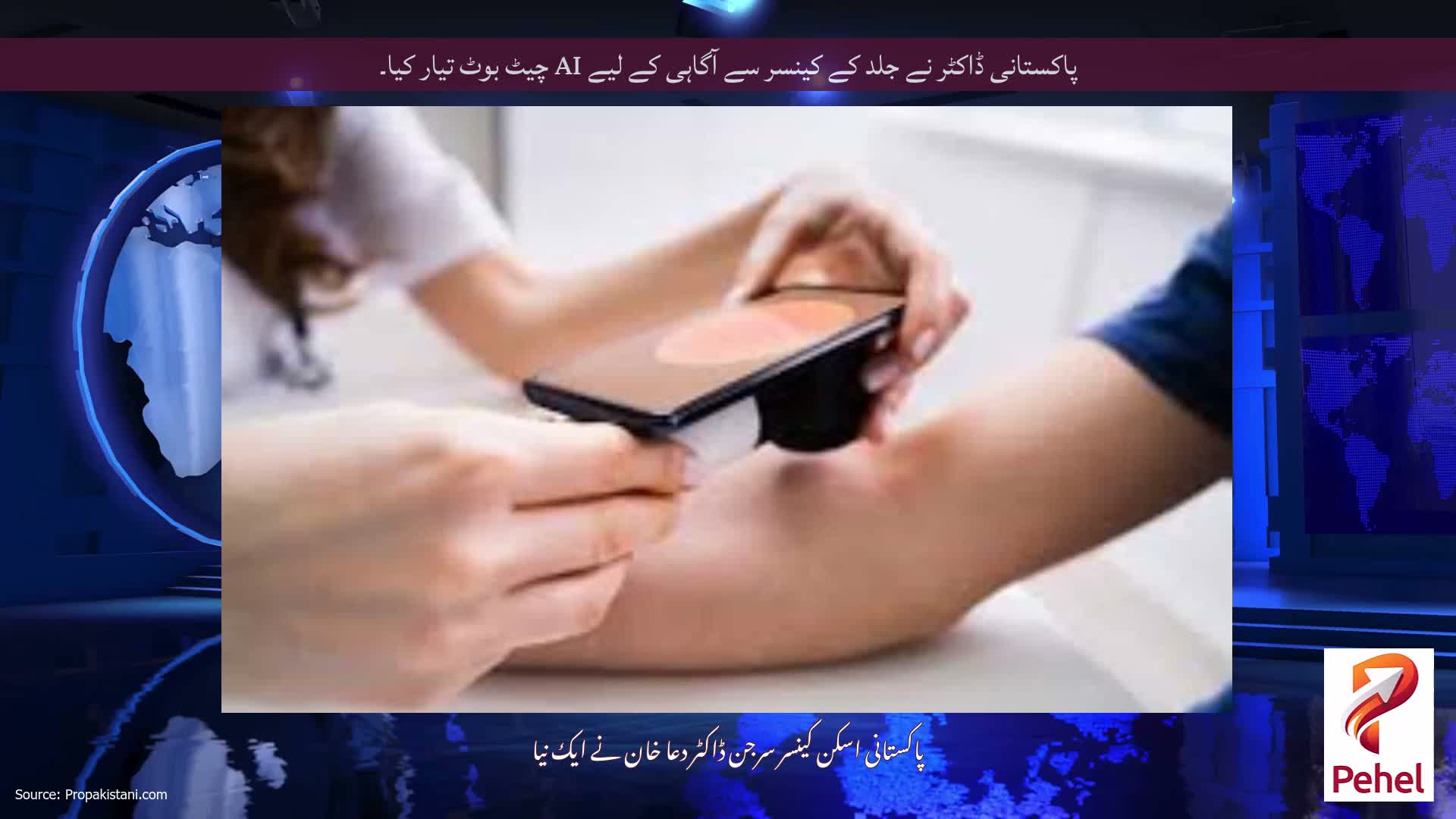 پاکستانی ڈاکٹر نے جلد کے کینسر سے آگاہی کے لیے AI چیٹ بوٹ تیار کیا۔
