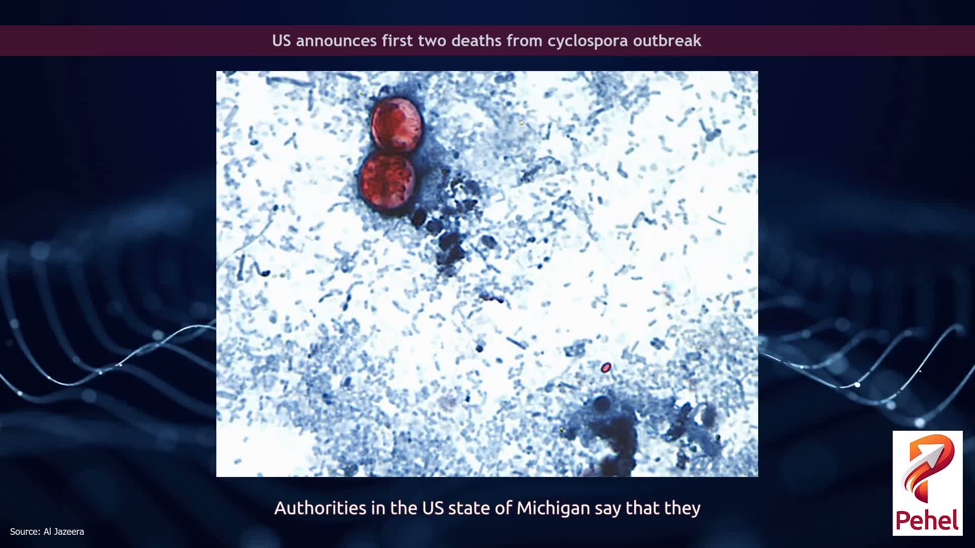 US announces first two deaths from cyclospora outbreak