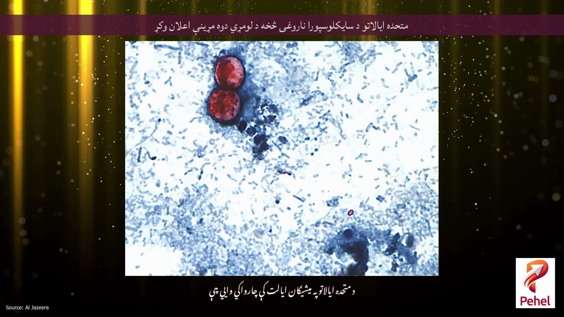 متحده ایالاتو د سایکلوسپورا ناروغۍ څخه د لومړي دوه مړینې اعلان وکړ