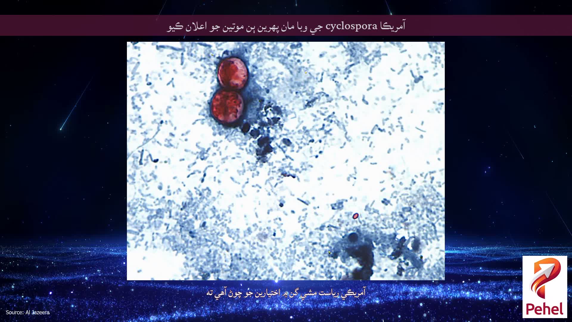 آمريڪا cyclospora جي وبا مان پهرين ٻن موتين جو اعلان ڪيو
