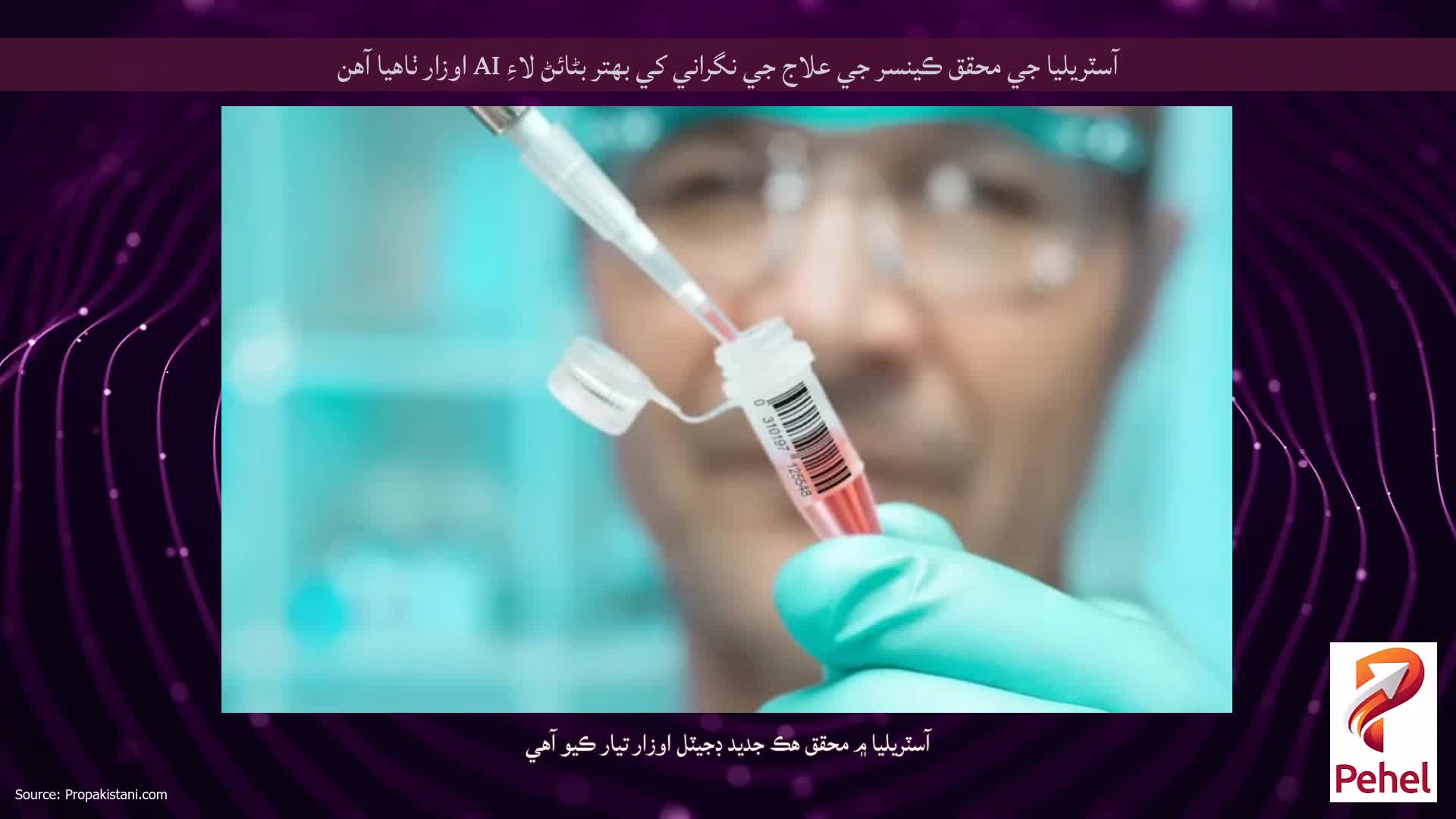 آسٽريليا جي محقق ڪينسر جي علاج جي نگراني کي بهتر بڻائڻ لاءِ AI اوزار ٺاهيا آهن