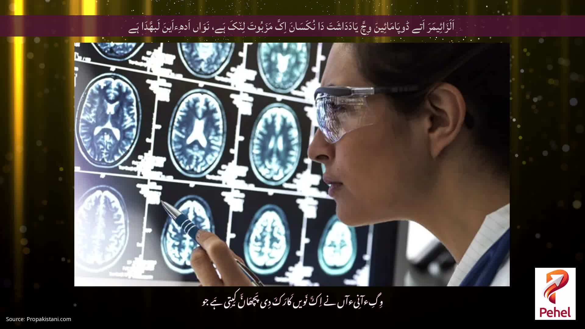 اَلَزَائِیمَرَ اَتے ڈوپَامَائِینَ وِچَّ یَادَدَاشَتَ دَا نُکَسَانَ اِکَّ مَزَبُوتَ ​​لِن٘کَ ہَے، نَوَاں اَدھِءاَینَ لَبھَّدَا ہَے