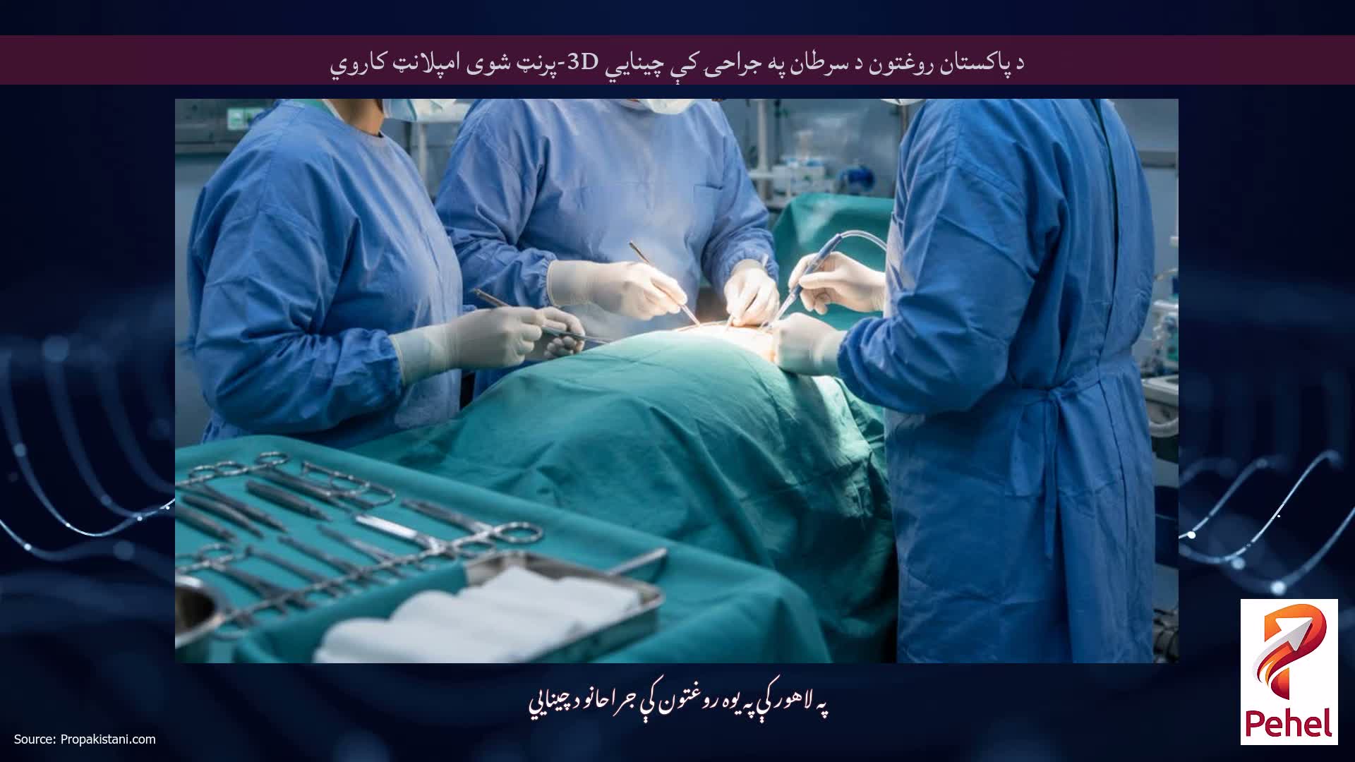 د پاکستان روغتون د سرطان په جراحۍ کې چینایي 3D-پرنټ شوی امپلانټ کاروي