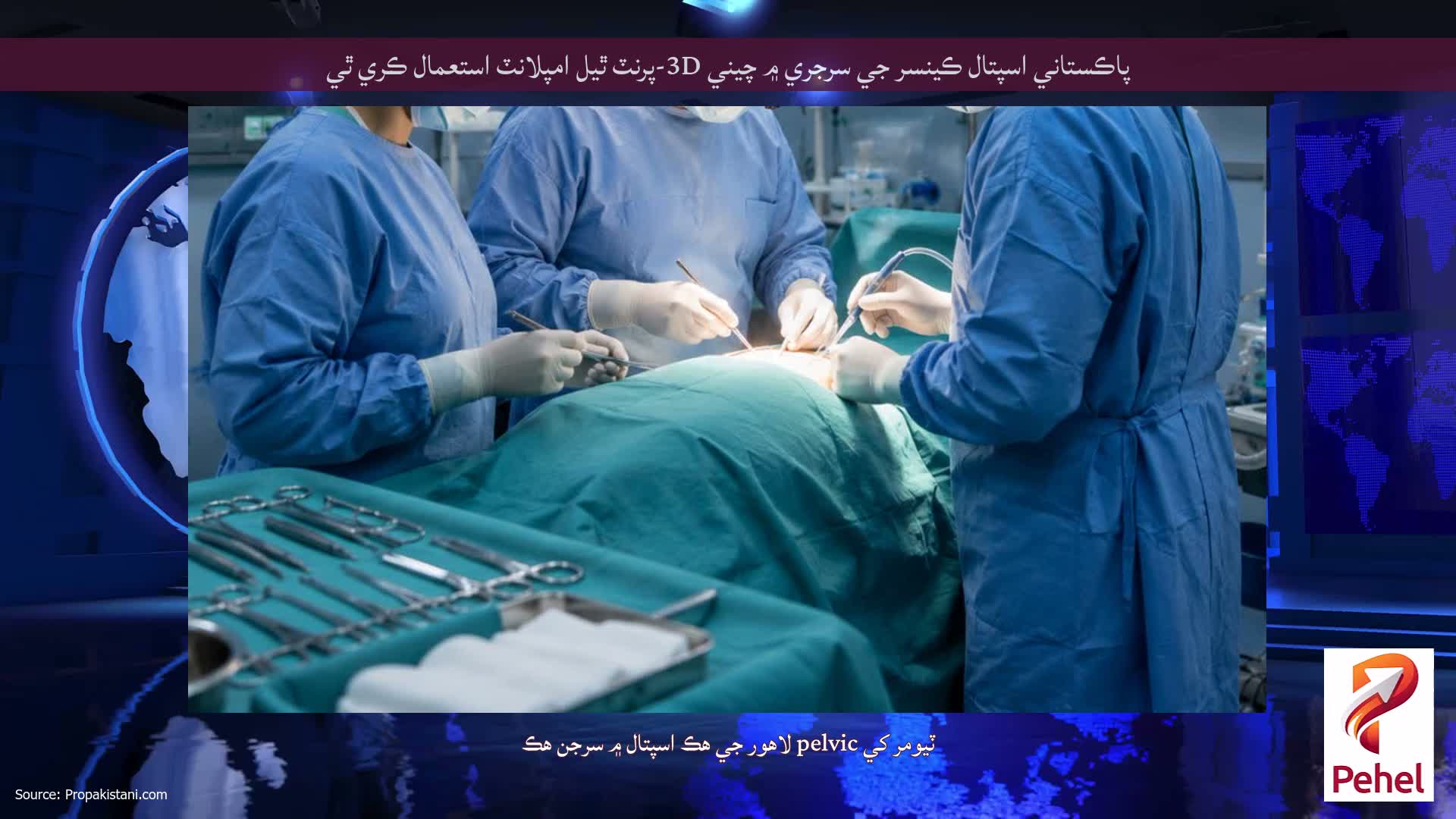 پاڪستاني اسپتال ڪينسر جي سرجري ۾ چيني 3D-پرنٽ ٿيل امپلانٽ استعمال ڪري ٿي