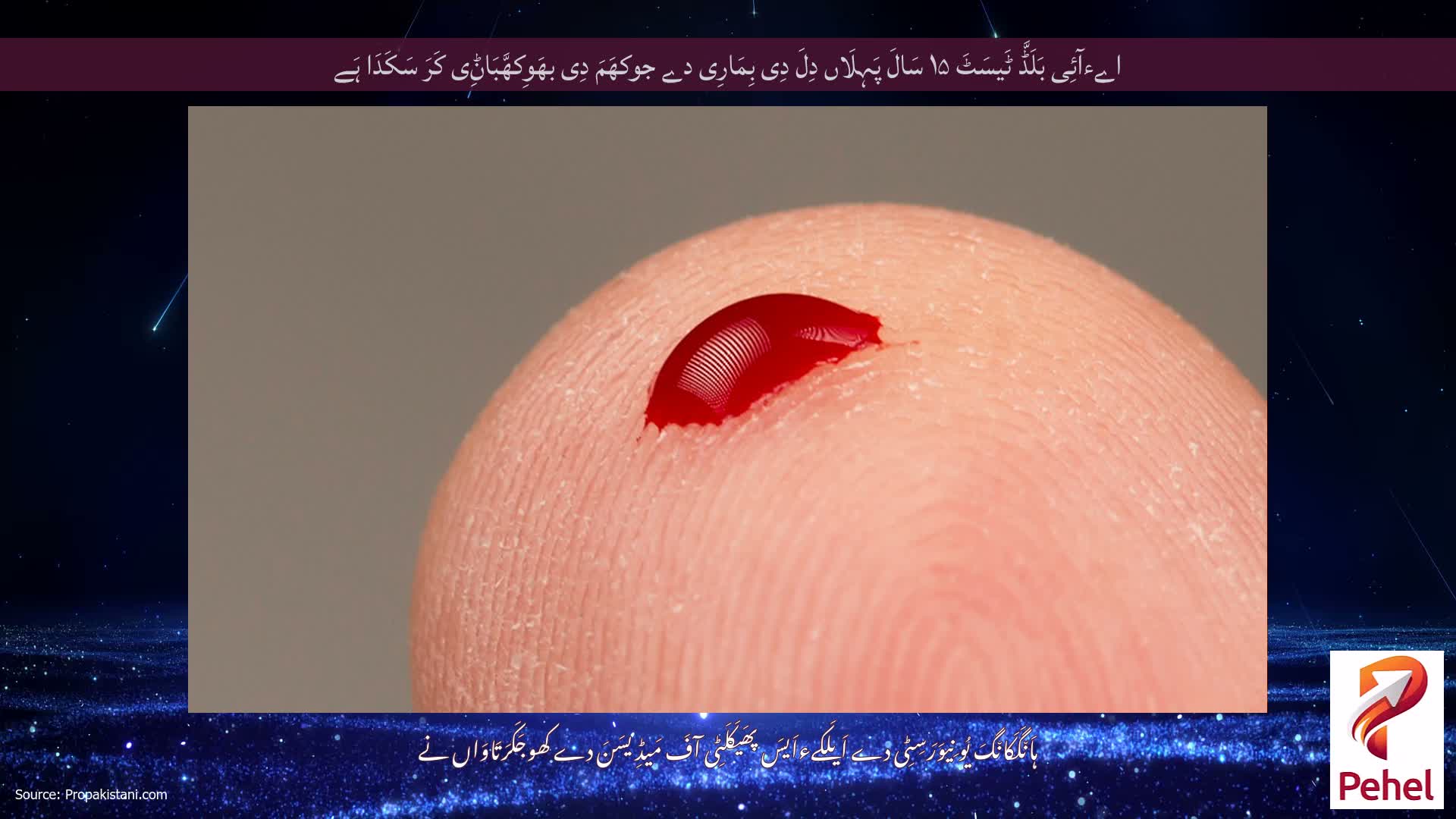 اےءآئِی بَلَڈَّ ٹَیسَٹَ ۱۵ سَالَ پَہِلَاں دِلَ دِی بِمَارِی دے جوکھَمَ دِی بھَوِکھَّبَاݨِی کَرَ سَکَدَا ہَے