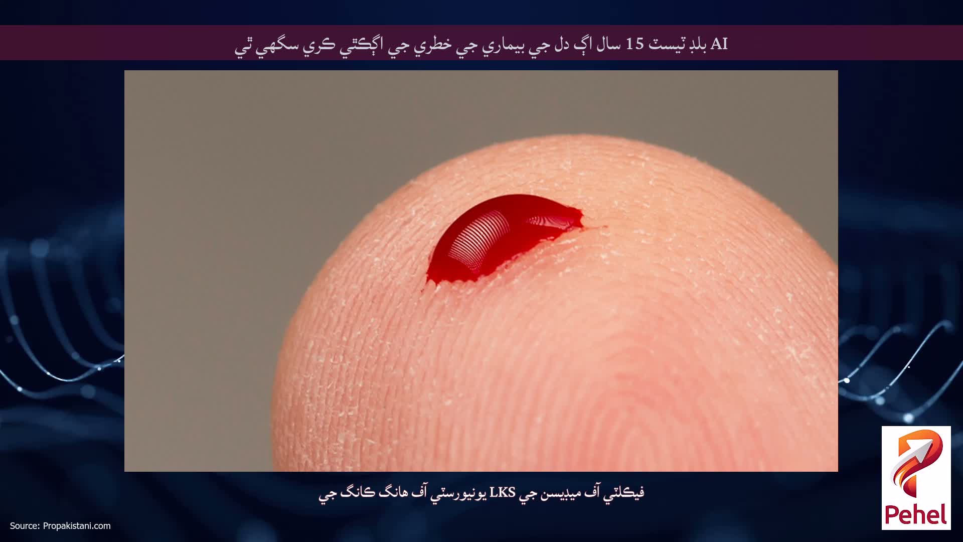 AI بلڊ ٽيسٽ 15 سال اڳ دل جي بيماري جي خطري جي اڳڪٿي ڪري سگهي ٿي