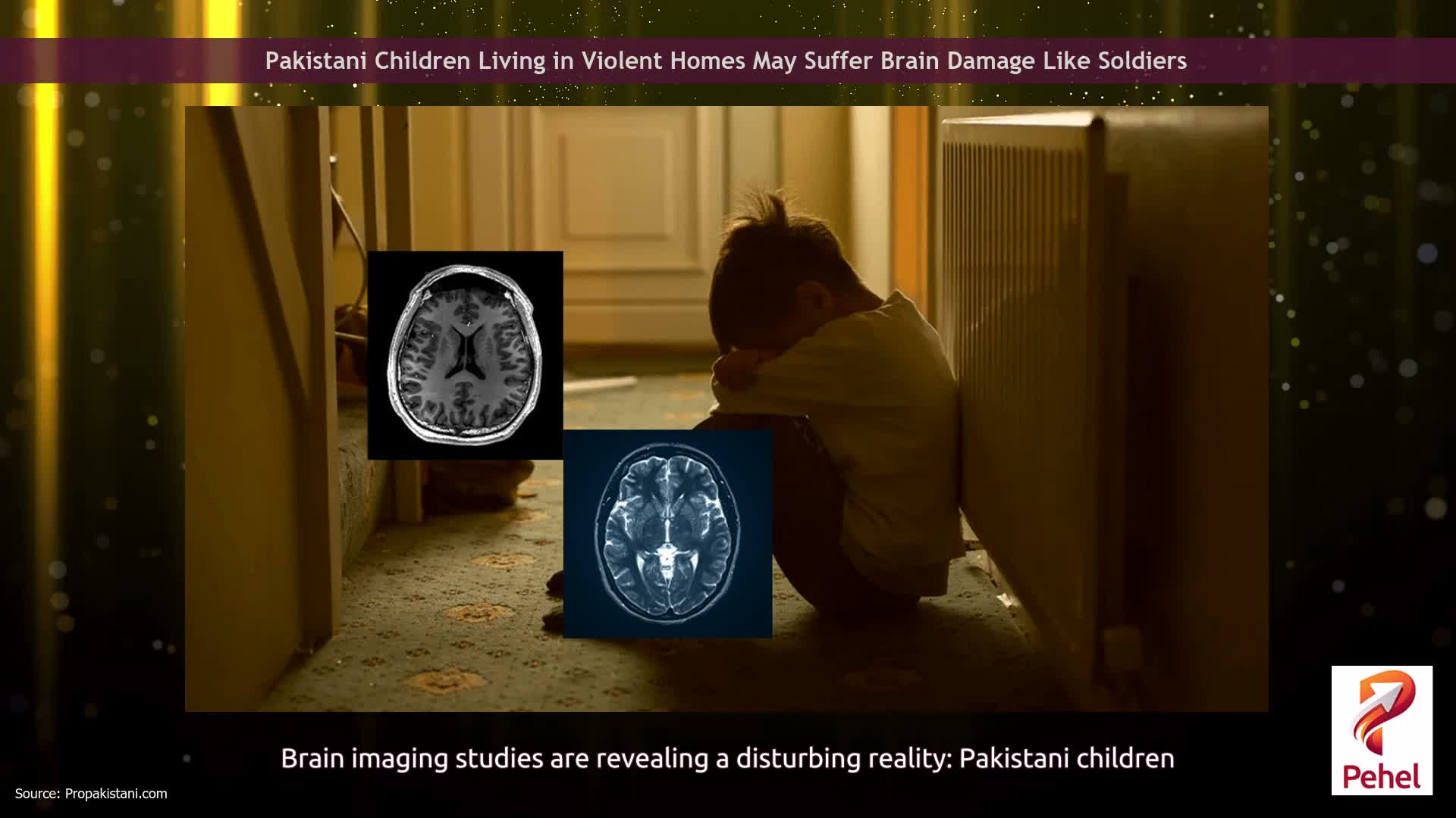 Pakistani Children Living in Violent Homes May Suffer Brain Damage Like Soldiers