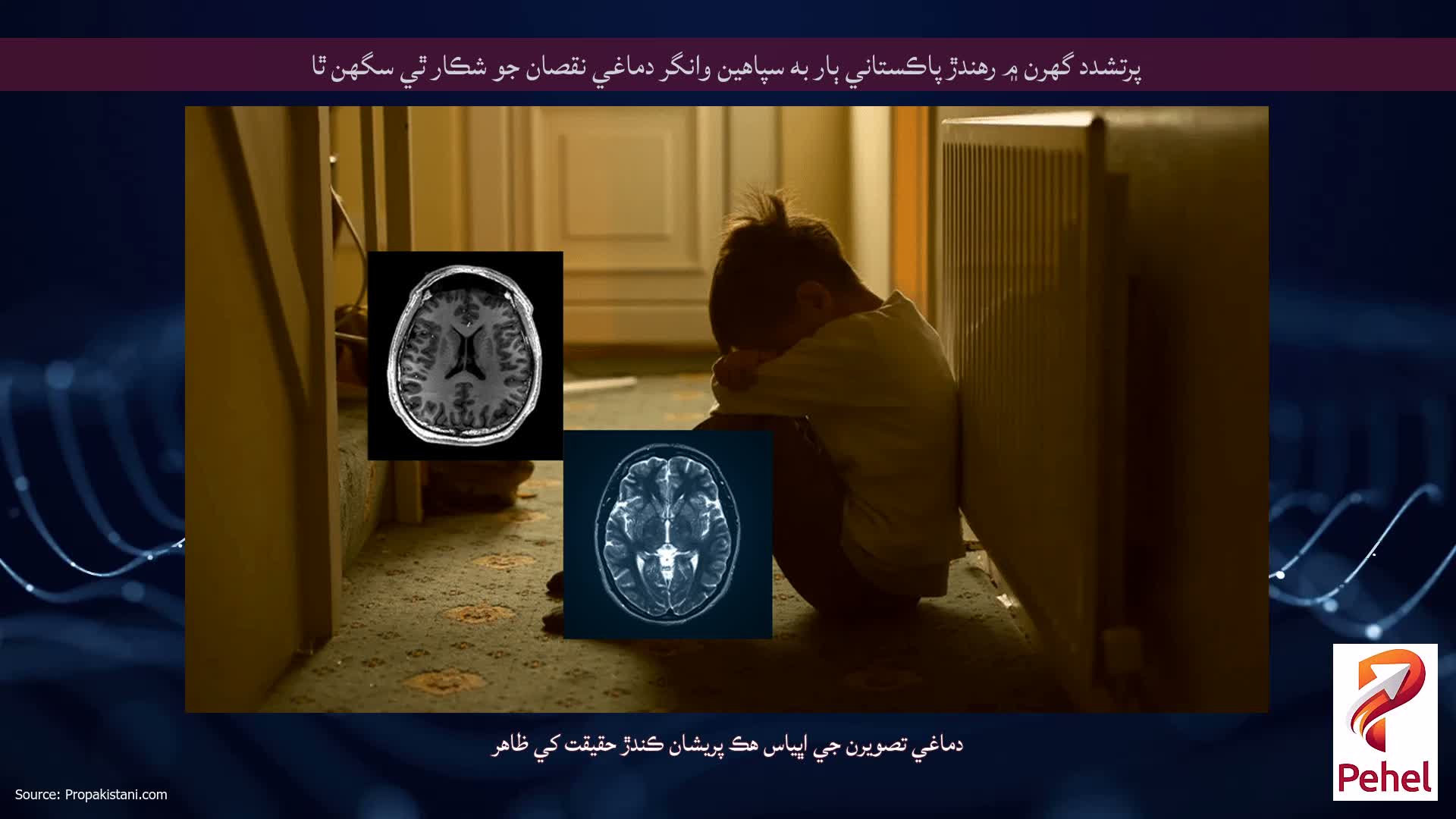 پرتشدد گهرن ۾ رهندڙ پاڪستاني ٻار به سپاهين وانگر دماغي نقصان جو شڪار ٿي سگهن ٿا