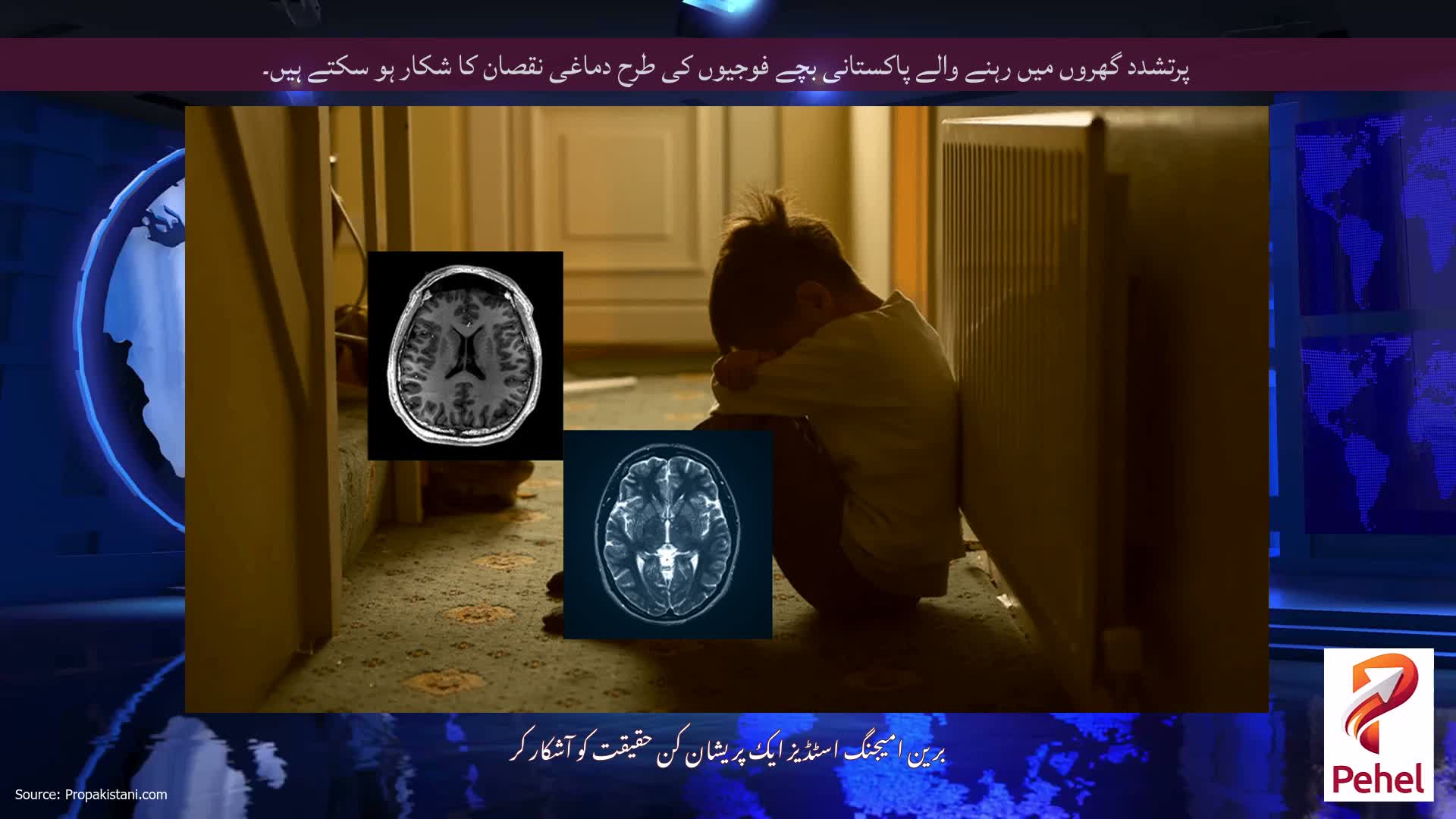 پرتشدد گھروں میں رہنے والے پاکستانی بچے فوجیوں کی طرح دماغی نقصان کا شکار ہو سکتے ہیں۔