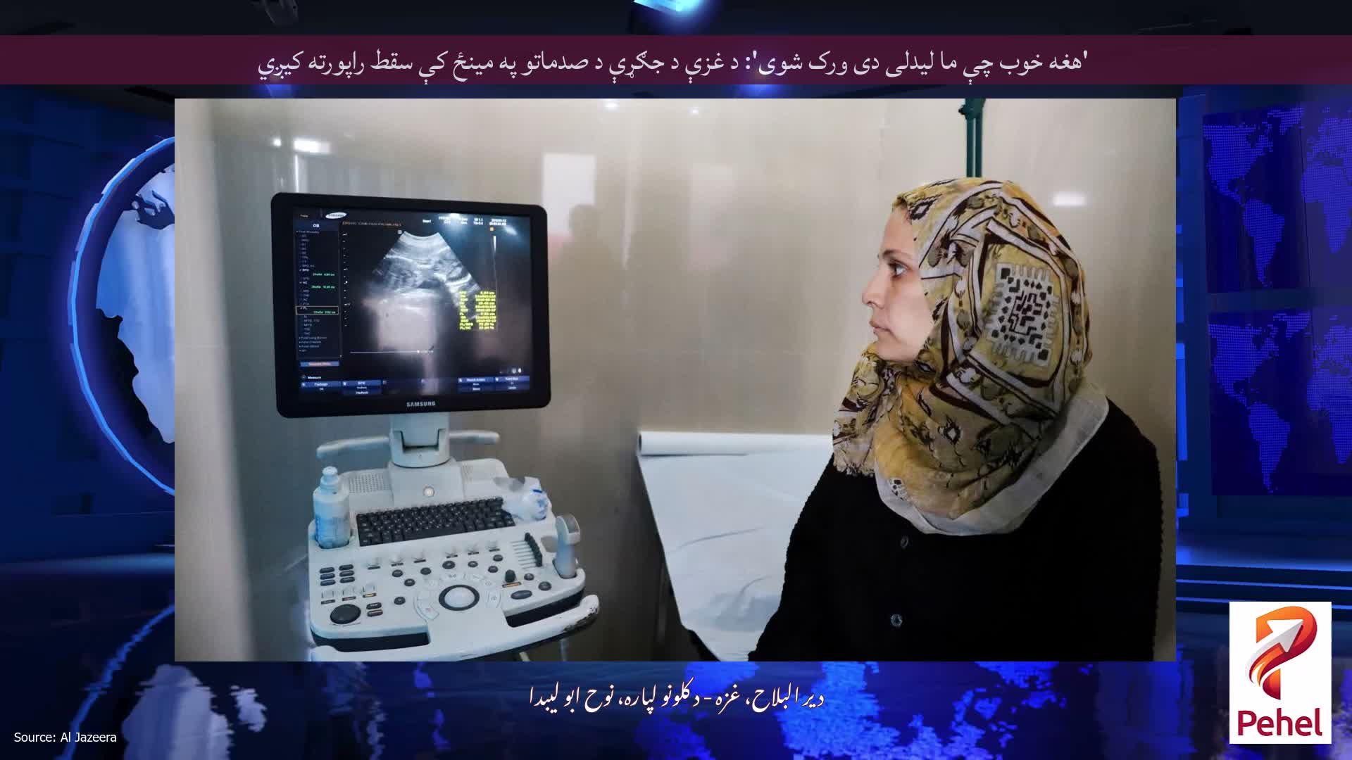 'هغه خوب چې ما لیدلی دی ورک شوی': د غزې د جګړې د صدماتو په مینځ کې سقط راپورته کیږي