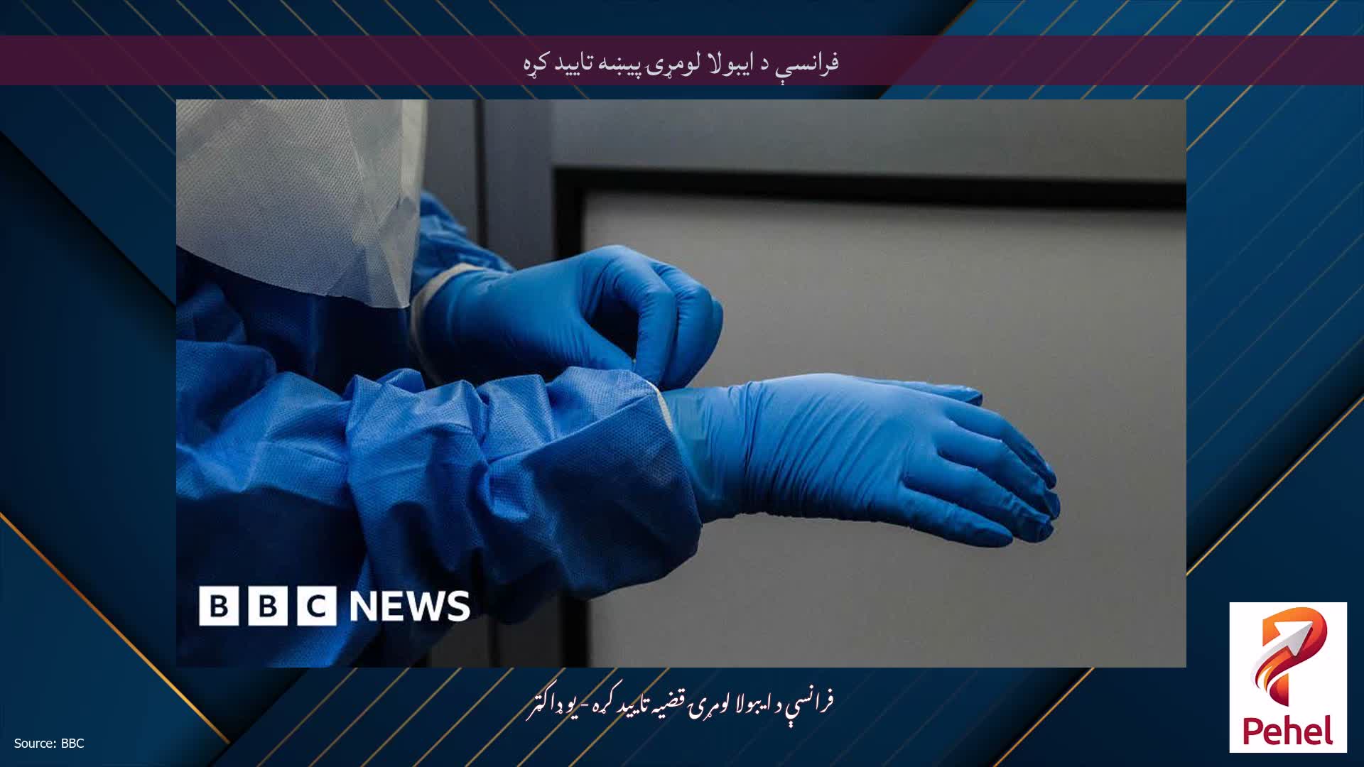 فرانسې د ایبولا لومړۍ پیښه تایید کړه